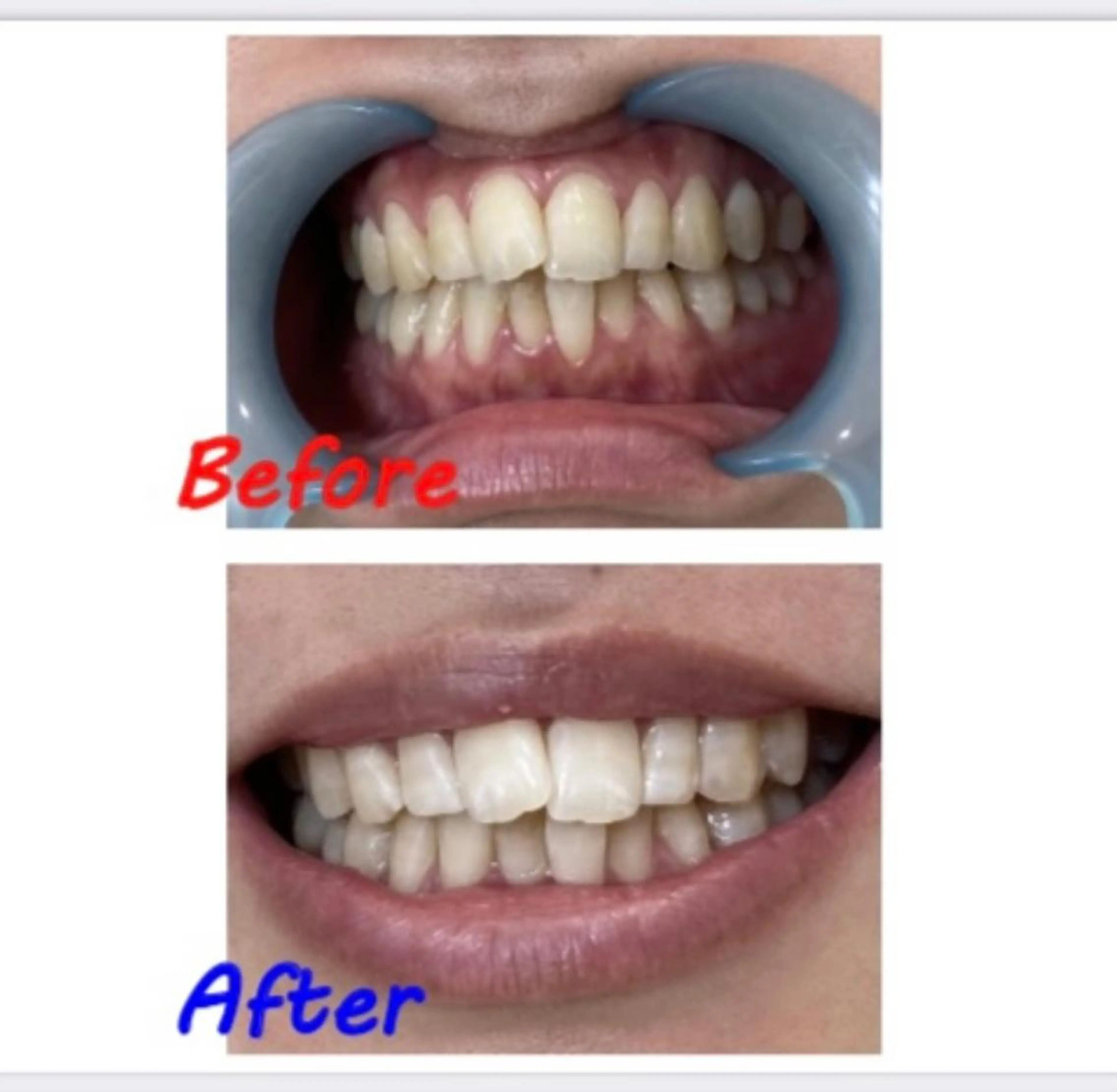 その他 セルフホワイトニングサロン　ラヴィアン所属・ホワイトニングサロン La vie enのその他イメージ