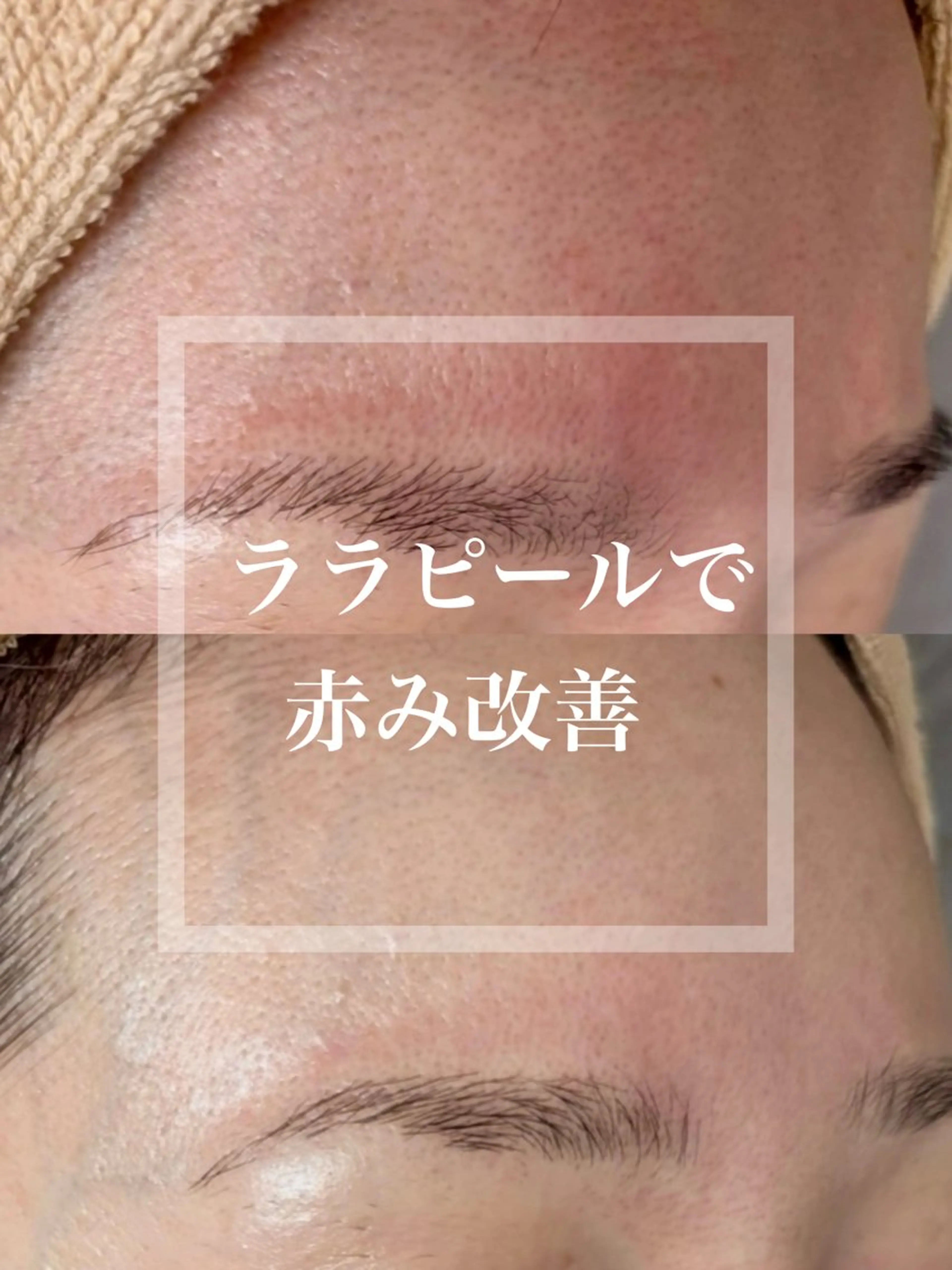 WHITE AQUA 北千住店のエステ・リラクイメージ