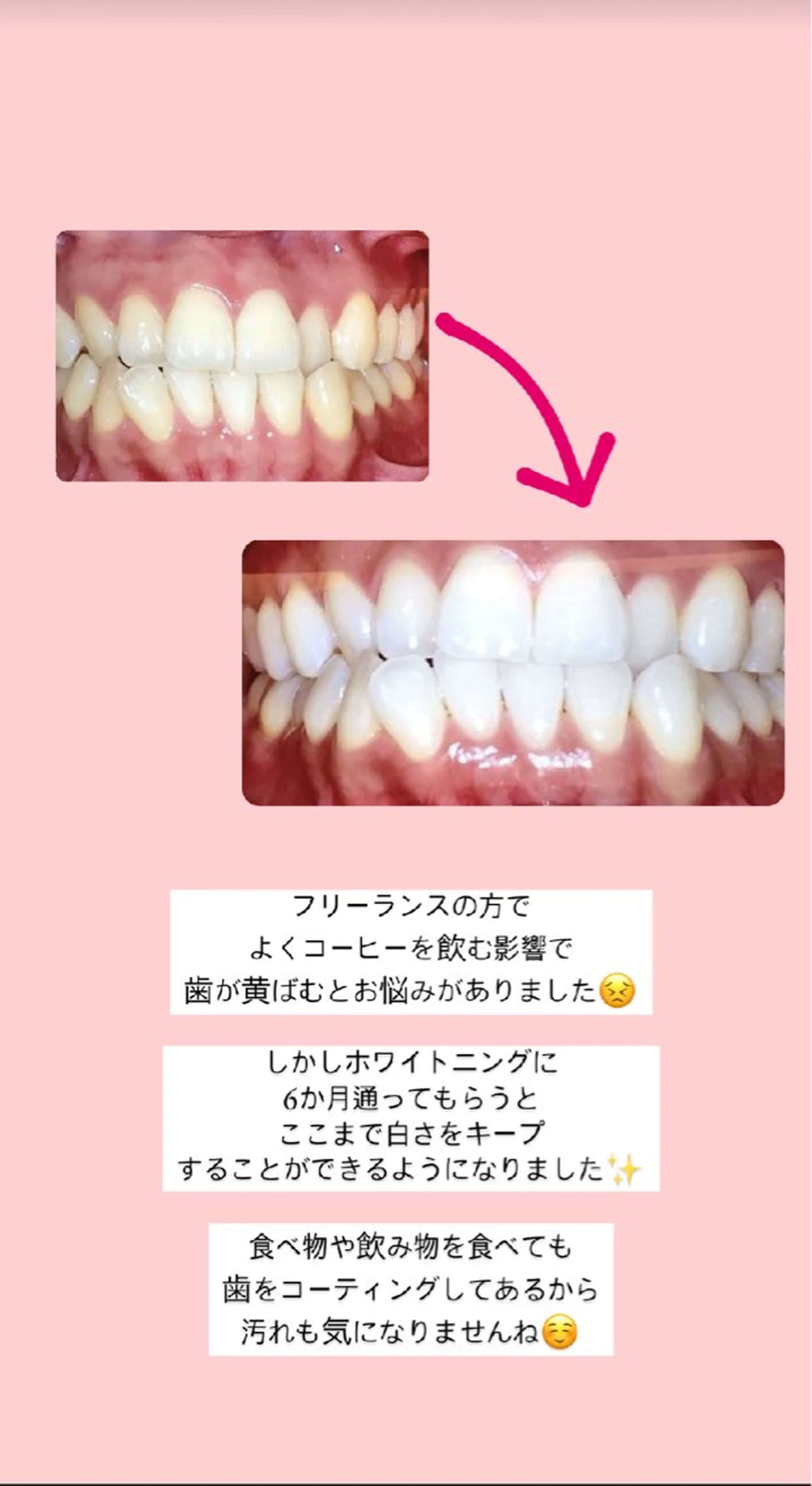ecxia  white 　広島袋町店所属・セルフホワイトニング エクシア広島袋町店のその他イメージ
