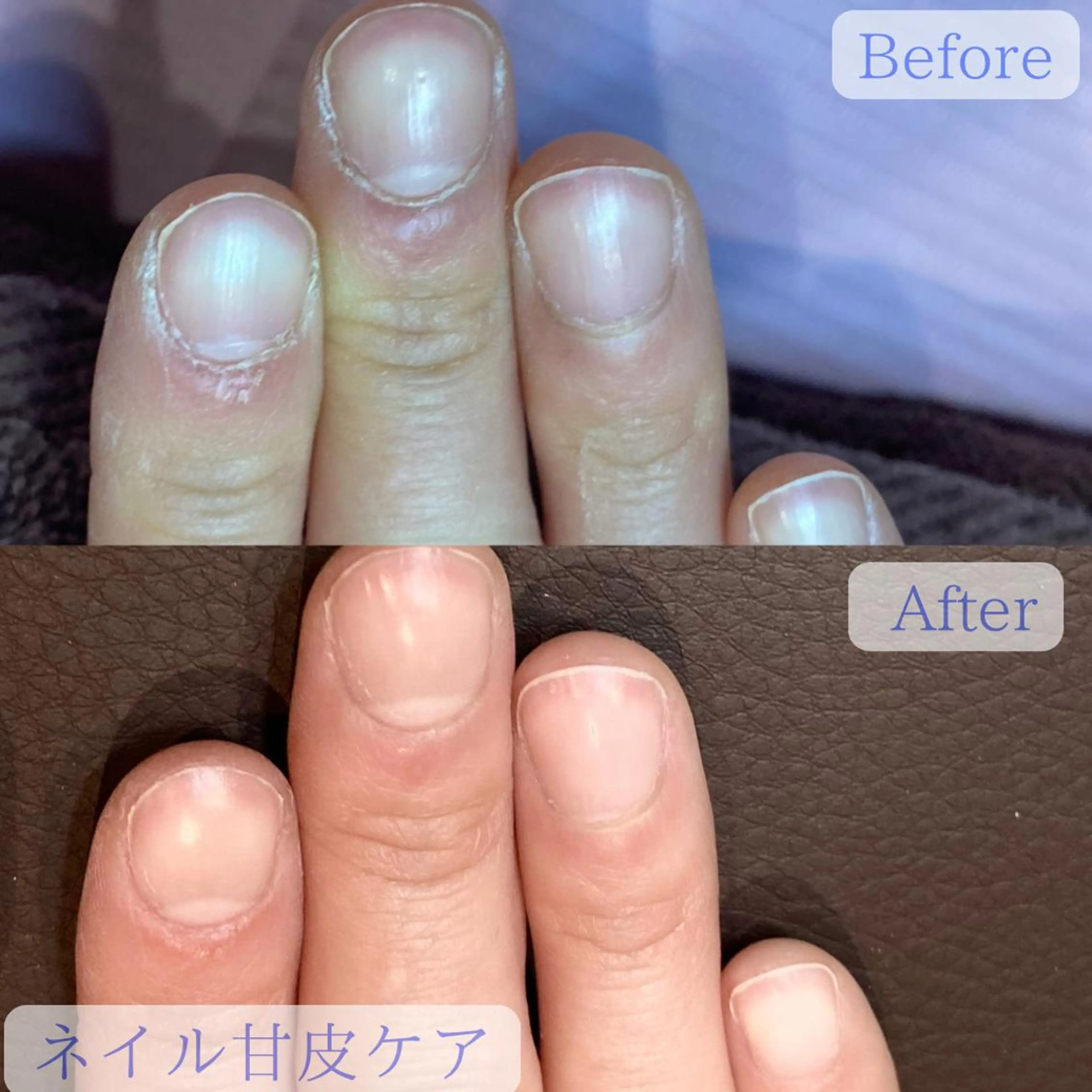 ハンド　甘皮ケア＋ハンドマッサージの写真