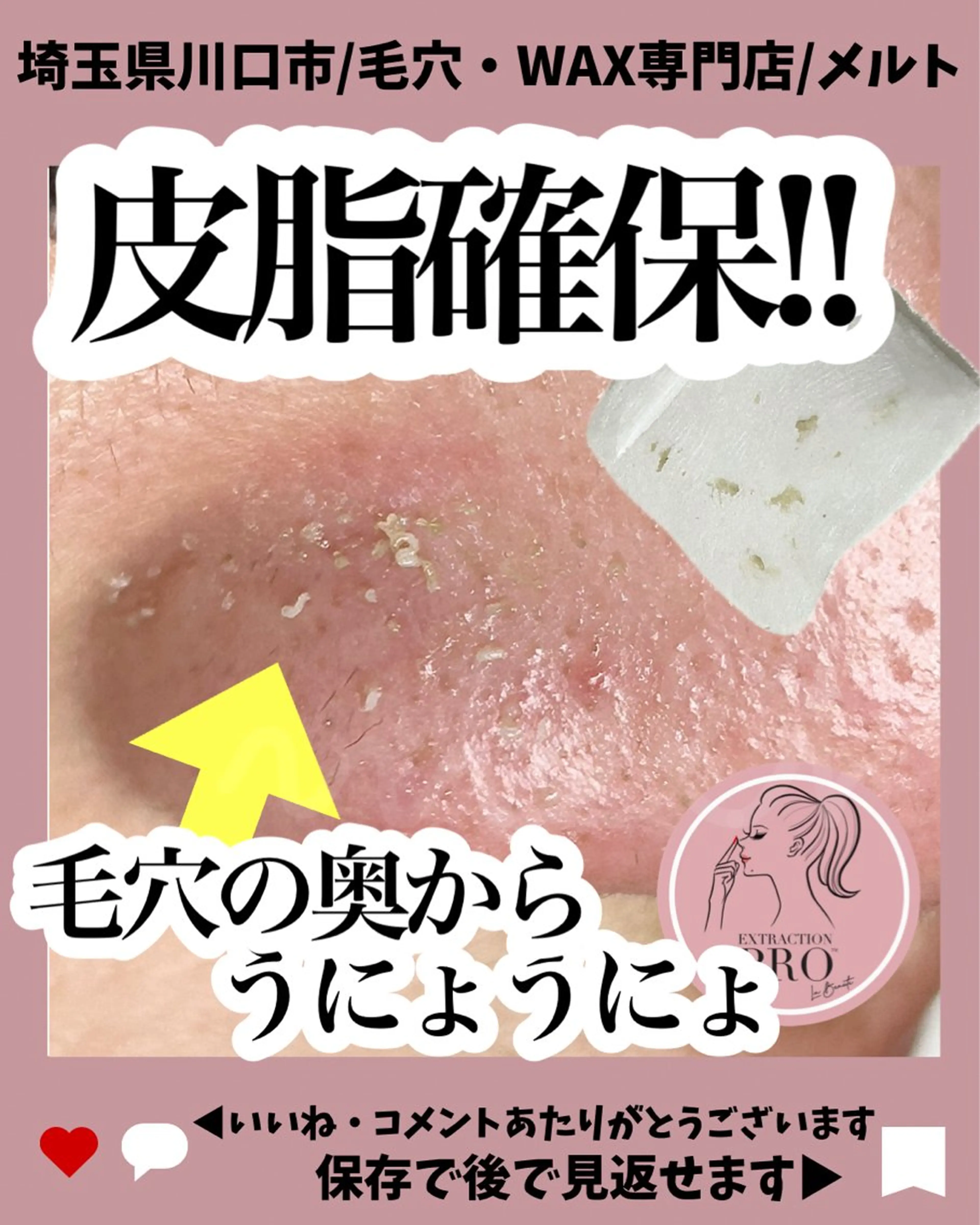 エステ melt まみのマツエク・マツパデザイン