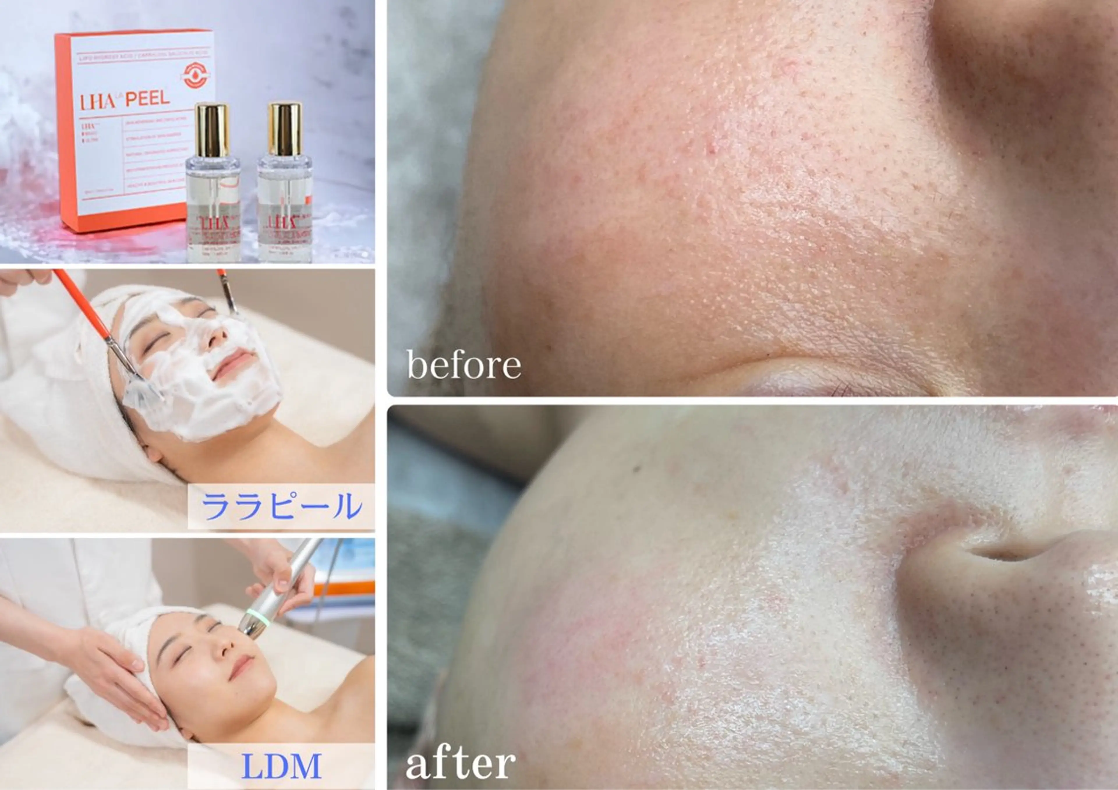 《ララピールとLDM》のセットメニュー🫧の写真