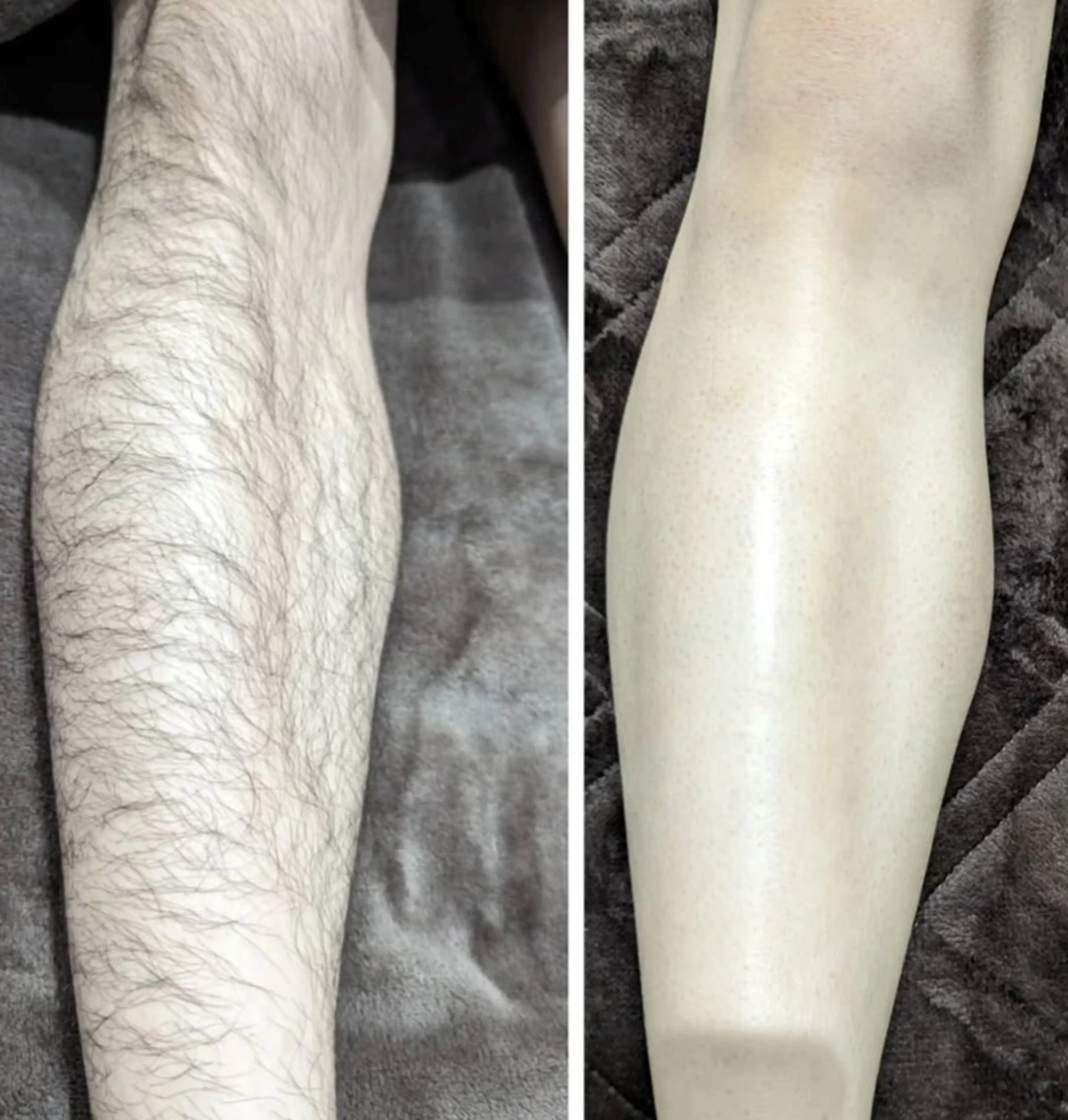 メンズ 姫路御立脱毛サロンSClass.所属・姫路御立脱毛サロン S Class.のエステ・リラクイメージ