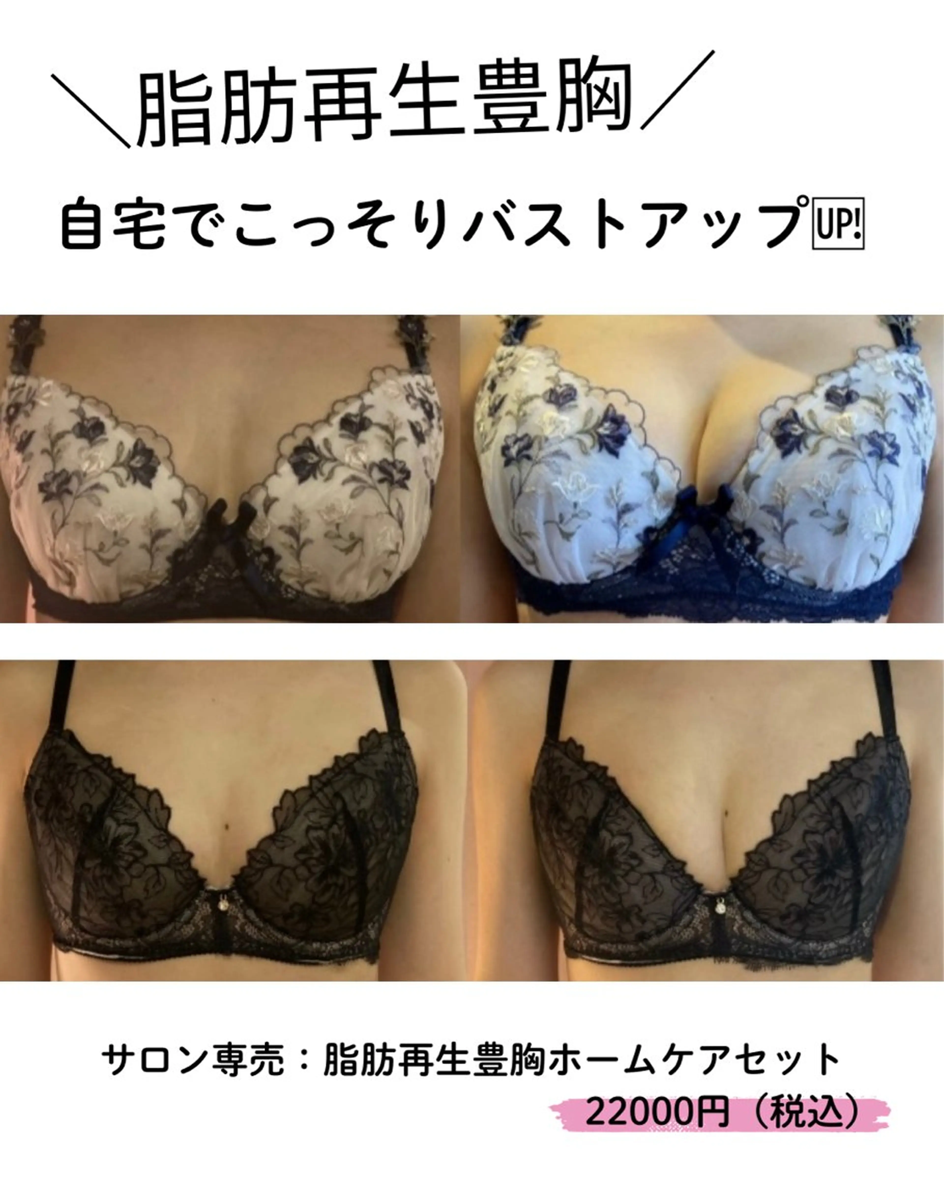 SalondoPutti所属・松本 春奈のエステ・リラクイメージ