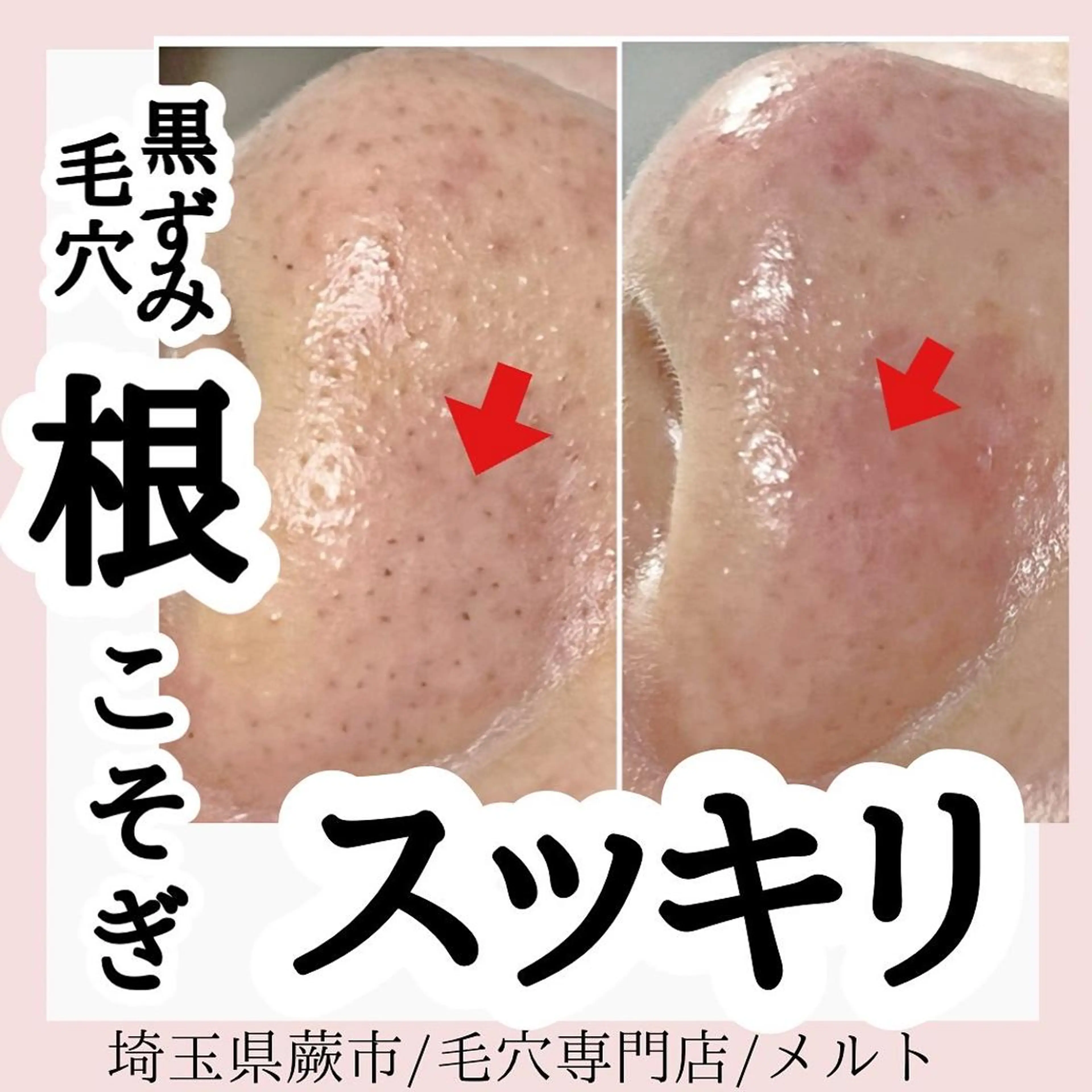 エステ melt まみのマツエク・マツパデザイン