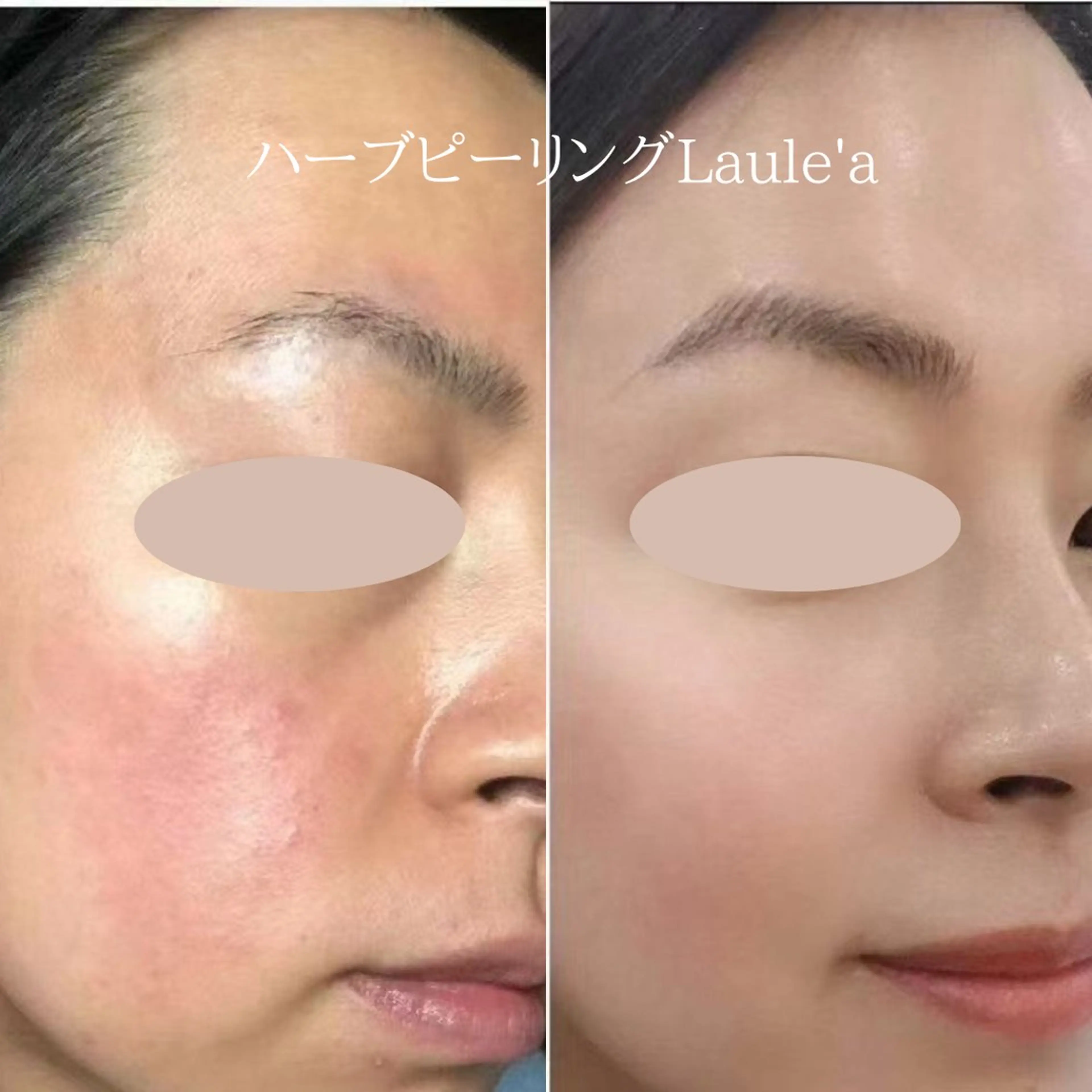 痩身/腸もみ/ ヘッドスパ/リンパのエステ・リラクイメージ