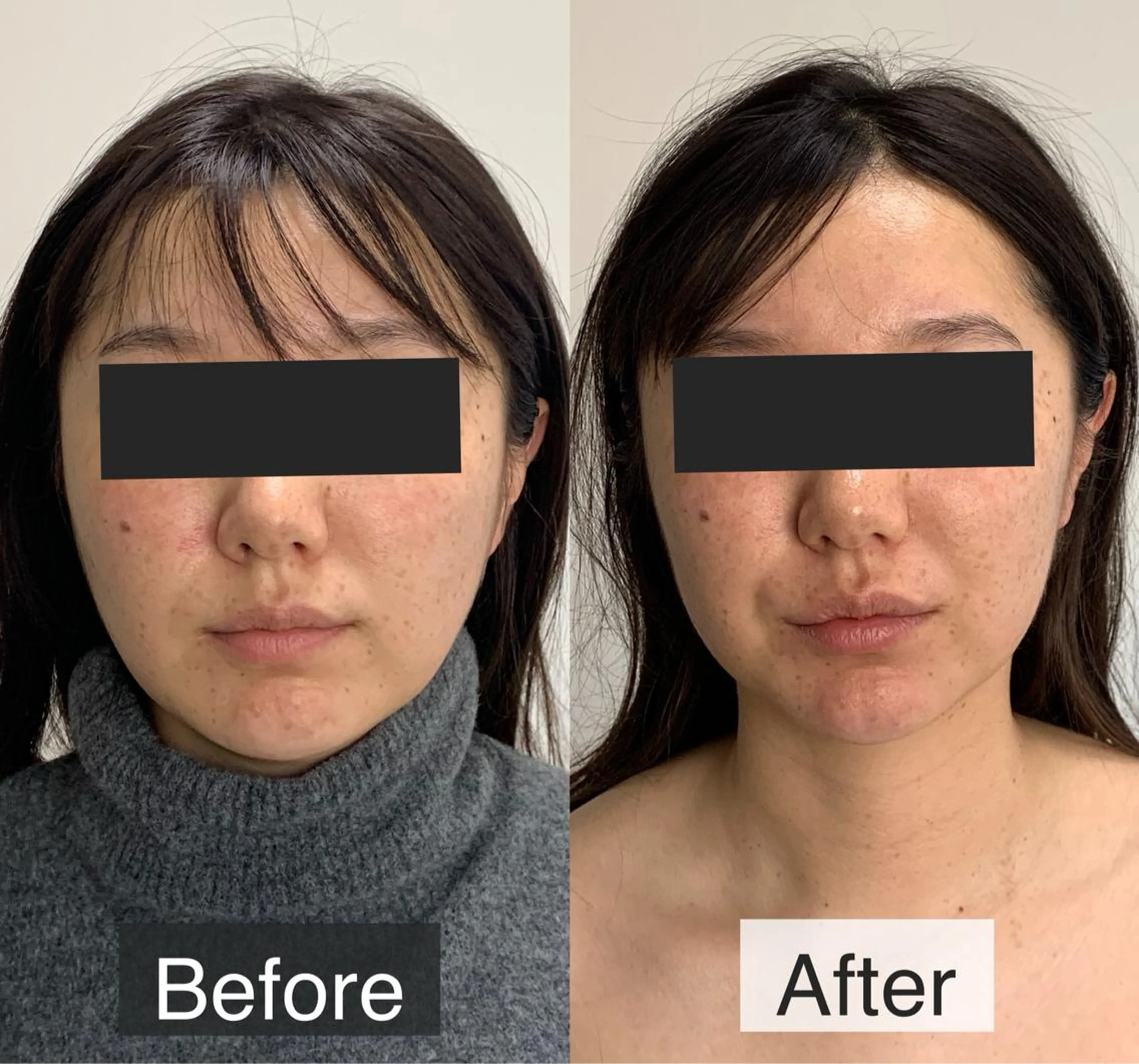 脱毛専門サロン BELFINE恵比寿のエステ・リラクイメージ