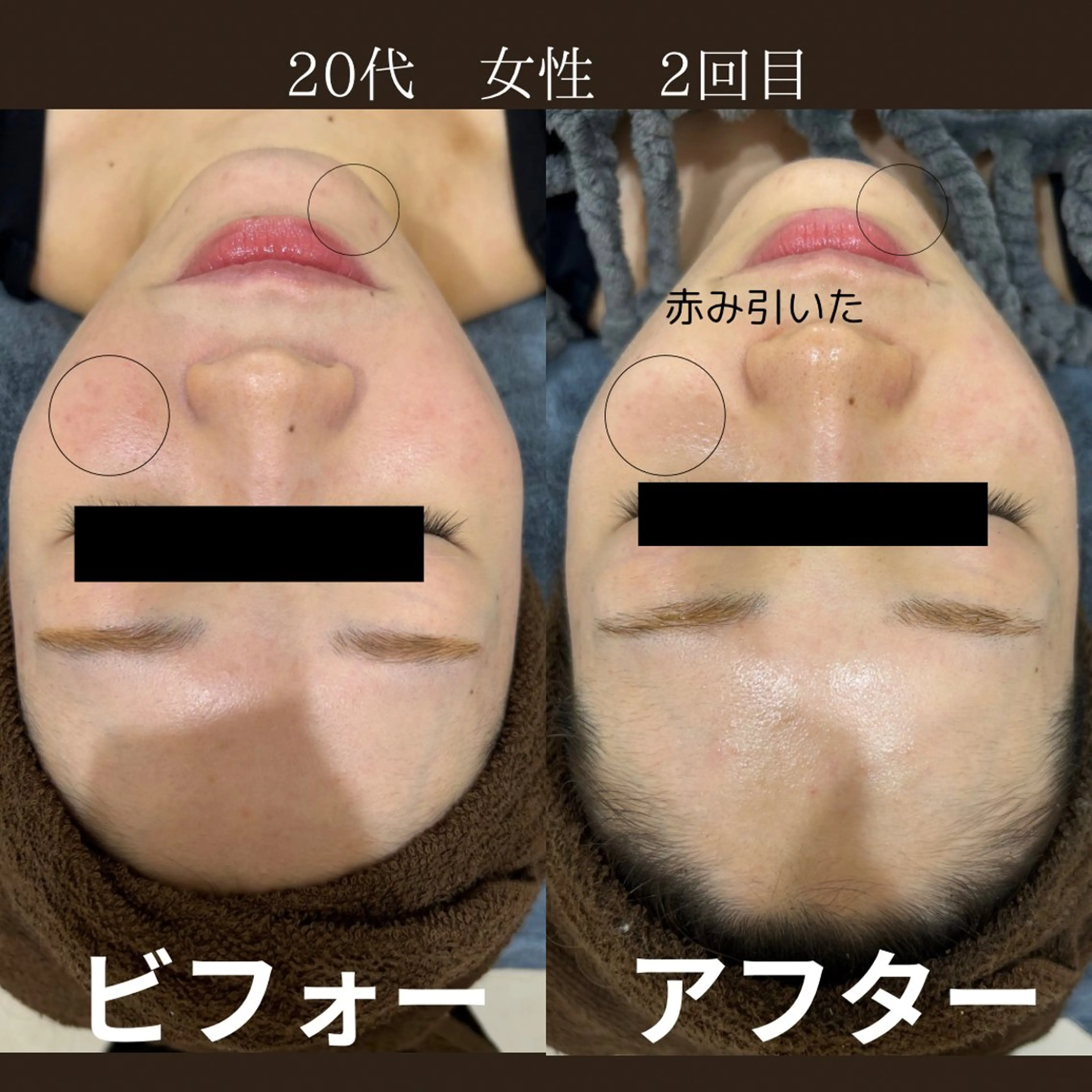 その他 NiU.BEAUTY🥥池袋店所属・ハーブピーリング専門 NiU.BEAUTYのエステ・リラクイメージ
