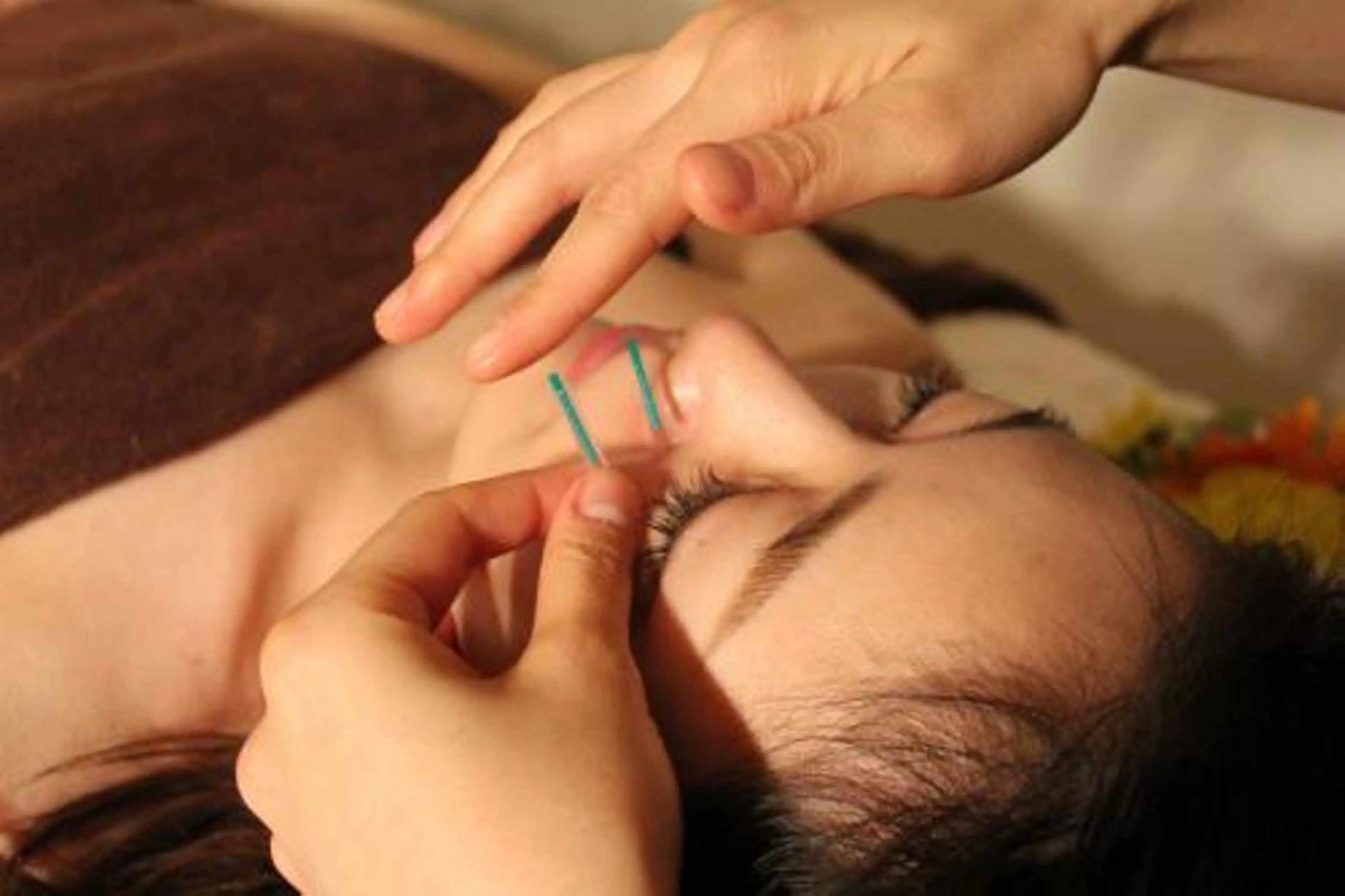 小顔矯正・美容鍼 美鍼堂のエステ・リラクイメージ