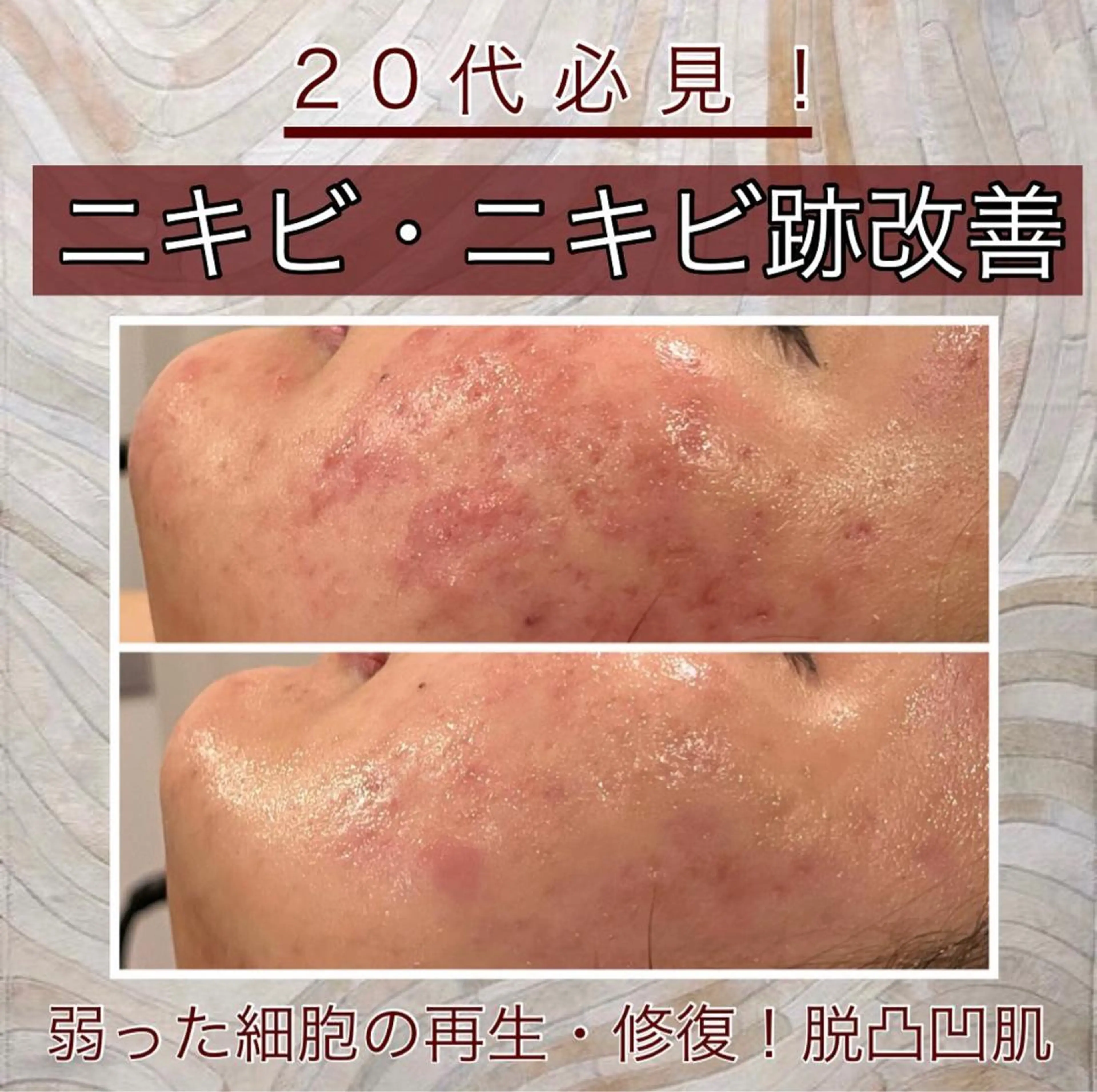 Meow！～トラブル肌専門ピーリング＆脱毛サロン～所属・トラブル肌改善🏥 Meow！🫧🫧のエステ・リラクイメージ
