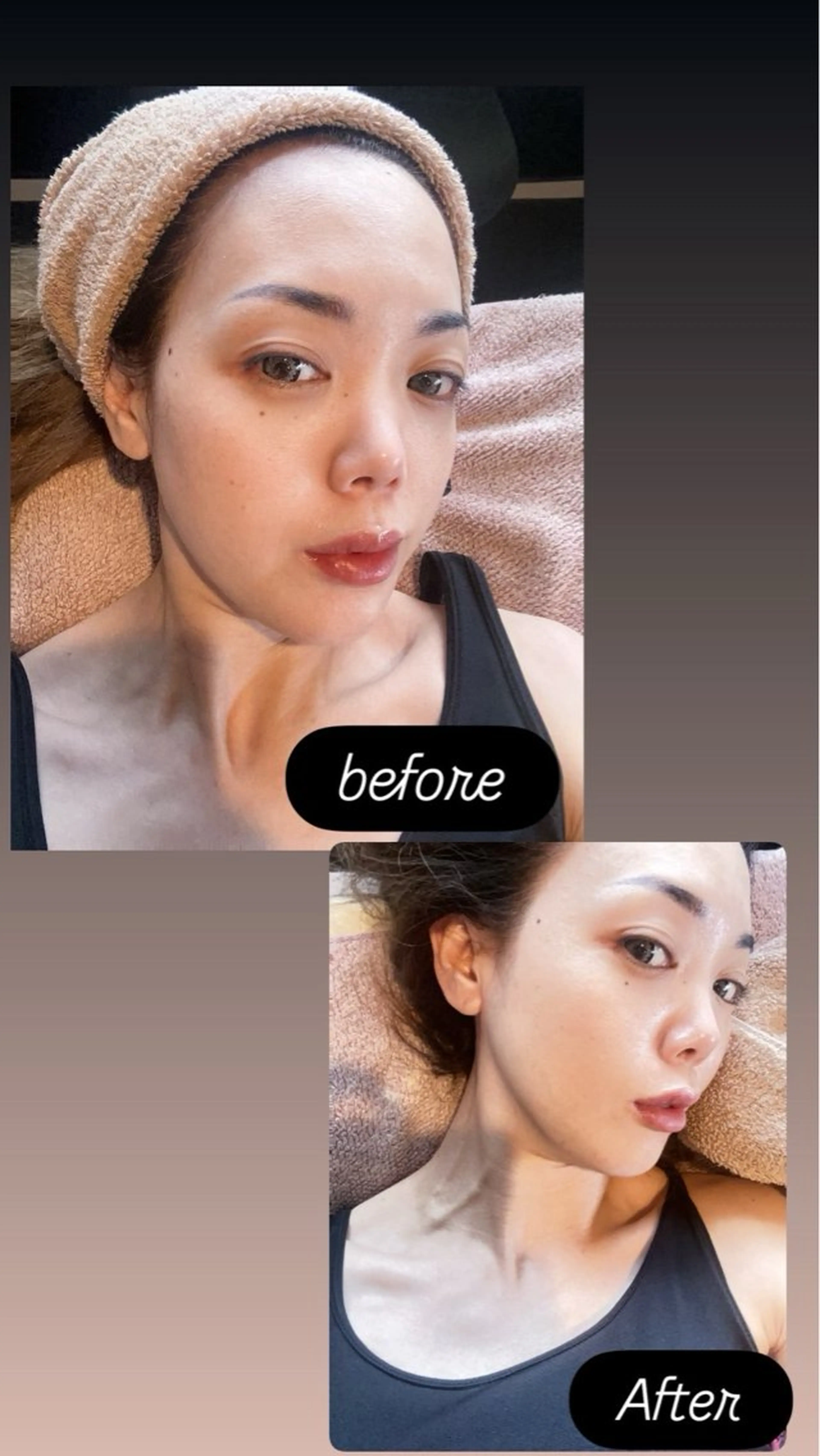 エステ Feather ビューティーサロンのネイルデザイン