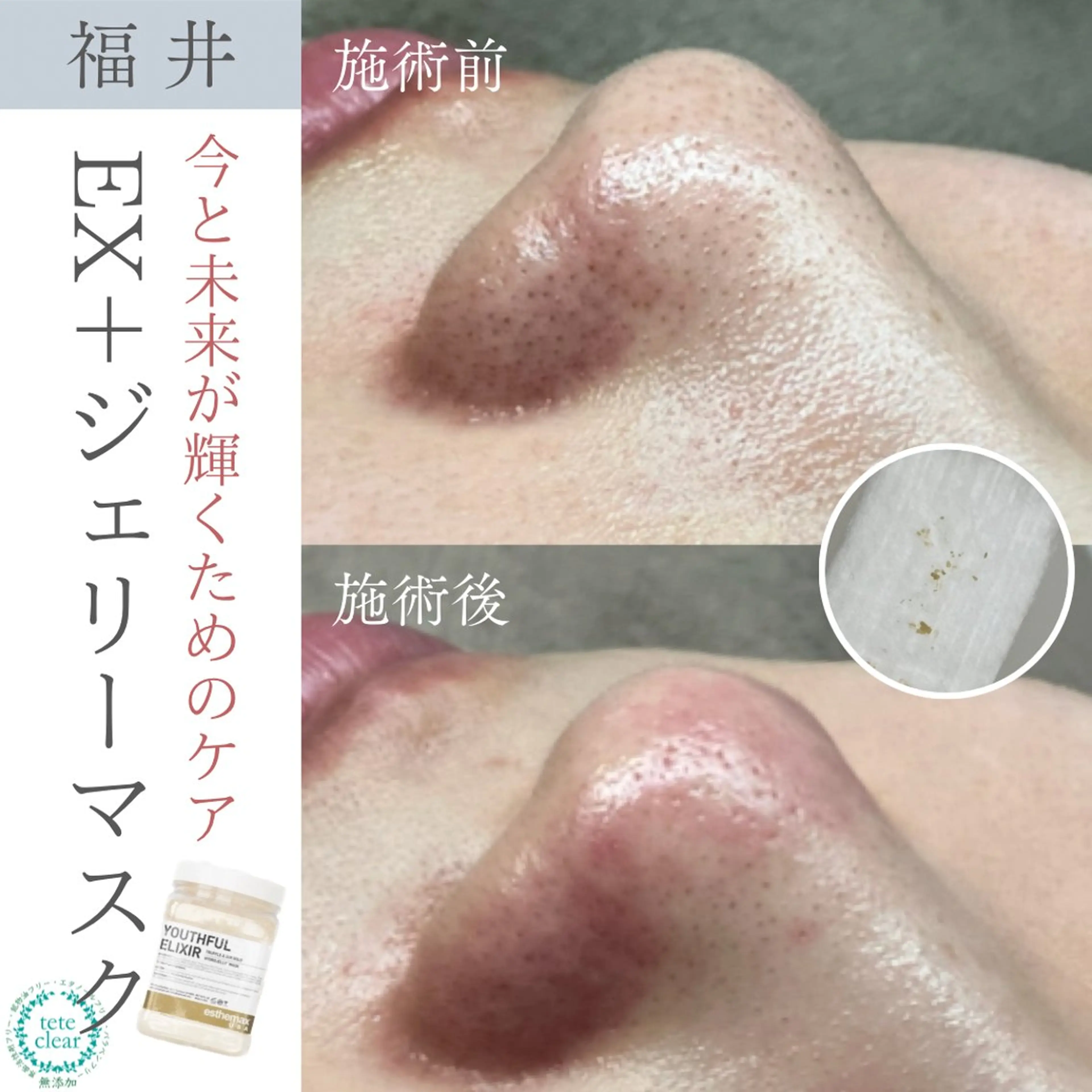毛穴ケア専門サロン Yourmeユアミーのエステ・リラクイメージ