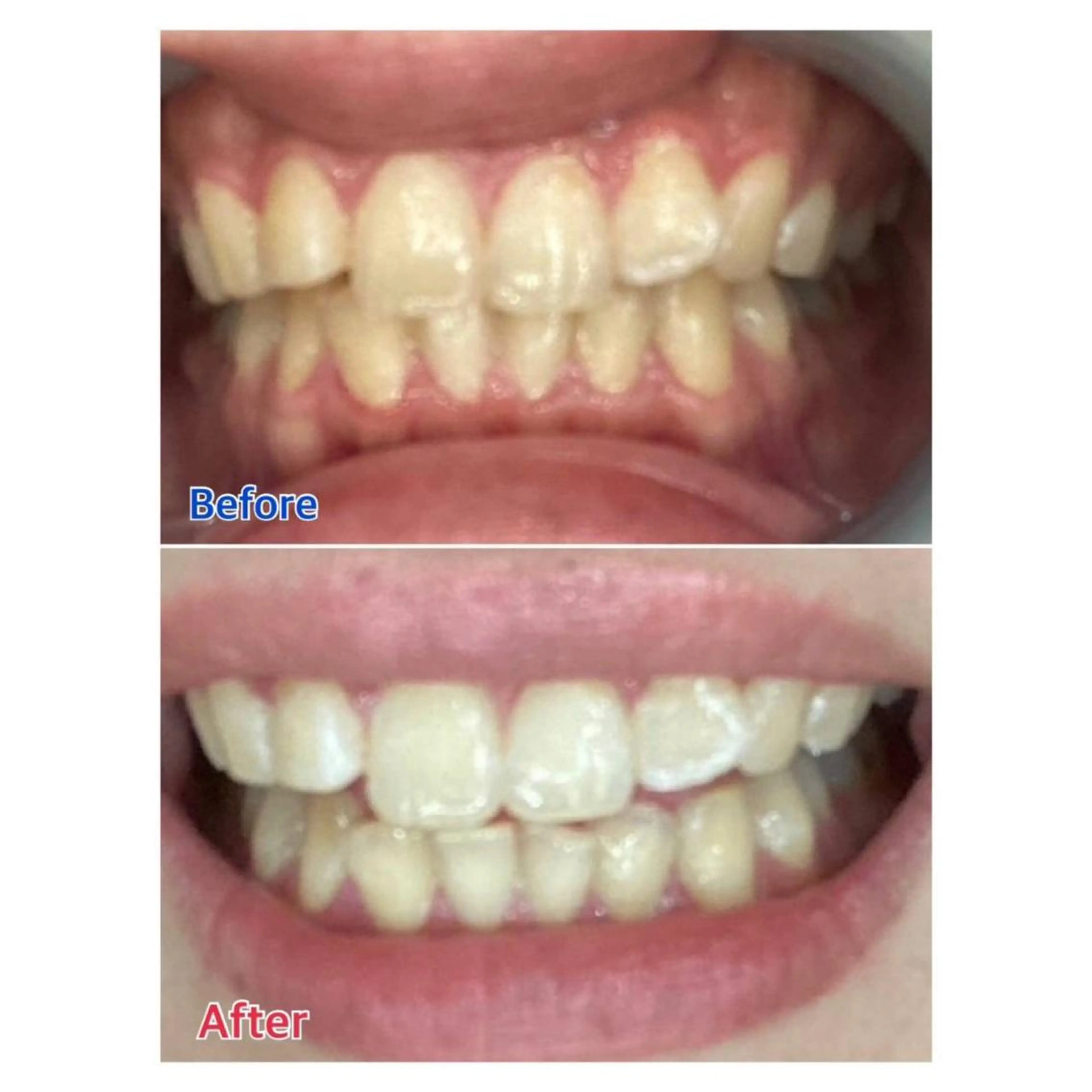 MBEAUTYSALON 千葉店・京成大久保所属・Melty 輝のその他イメージ