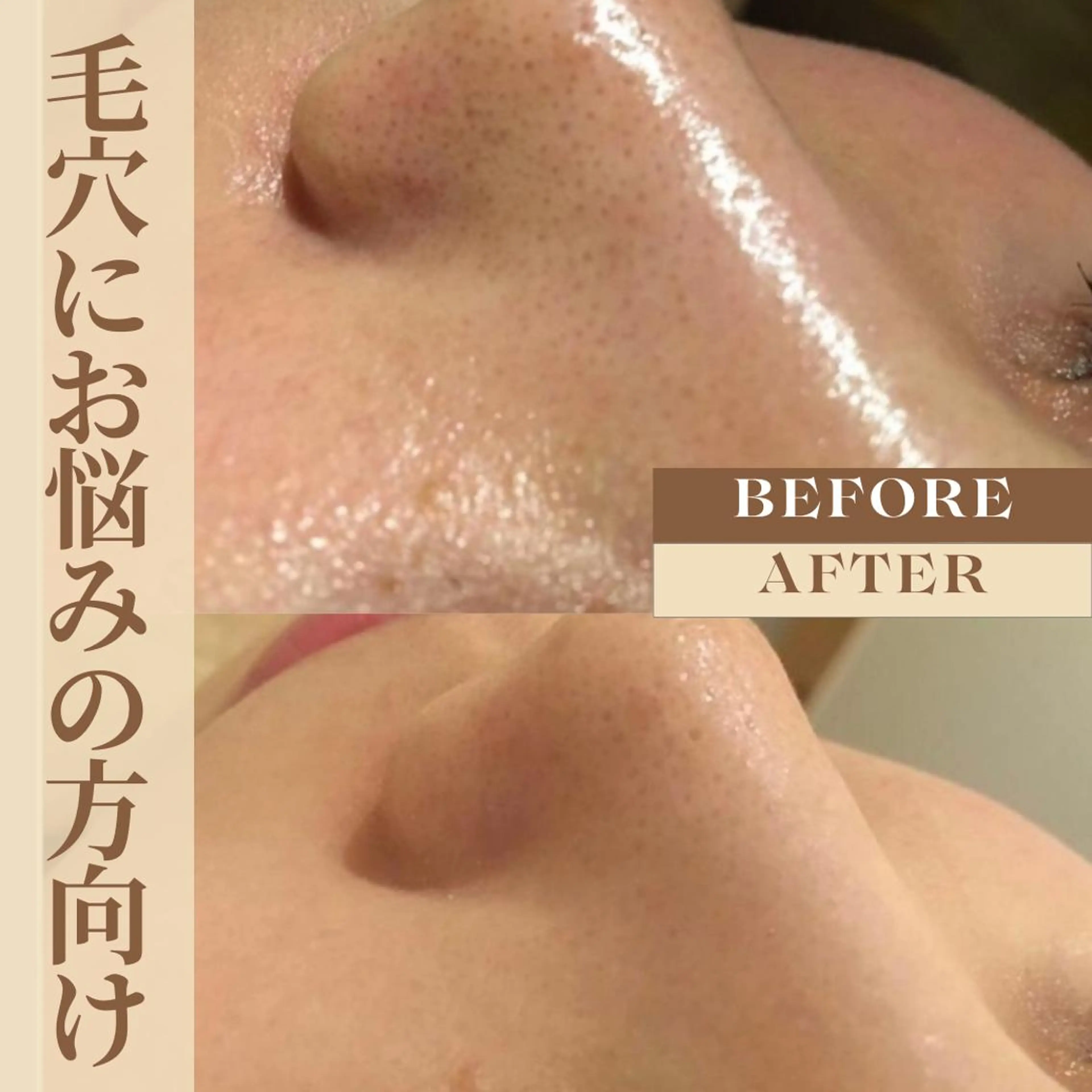 肌弱くてもOK！敏感 肌さんのためのサロンのエステ・リラクイメージ