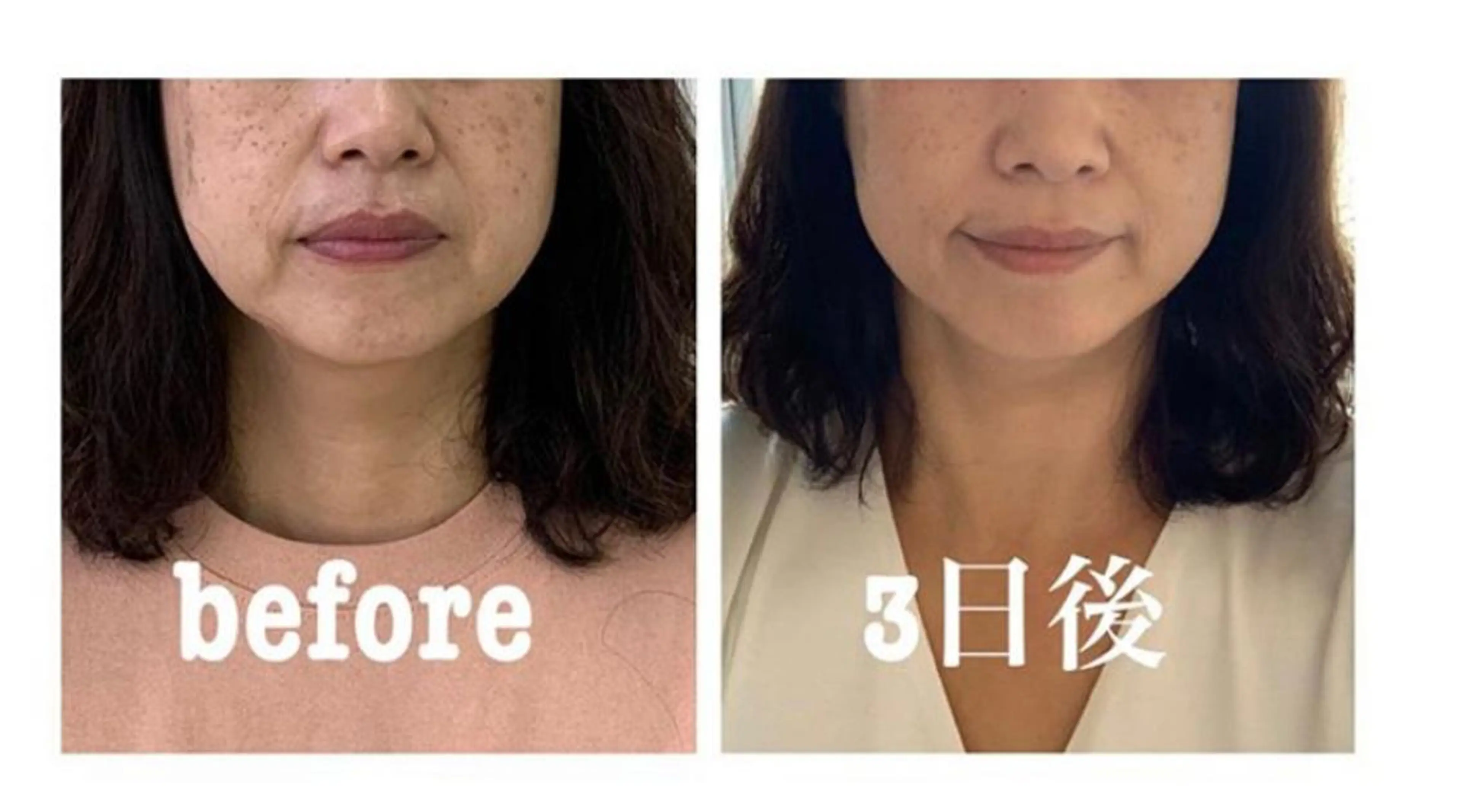 エステ リラク 小顔と ヘッドスパのお店のエステ・リラクイメージ