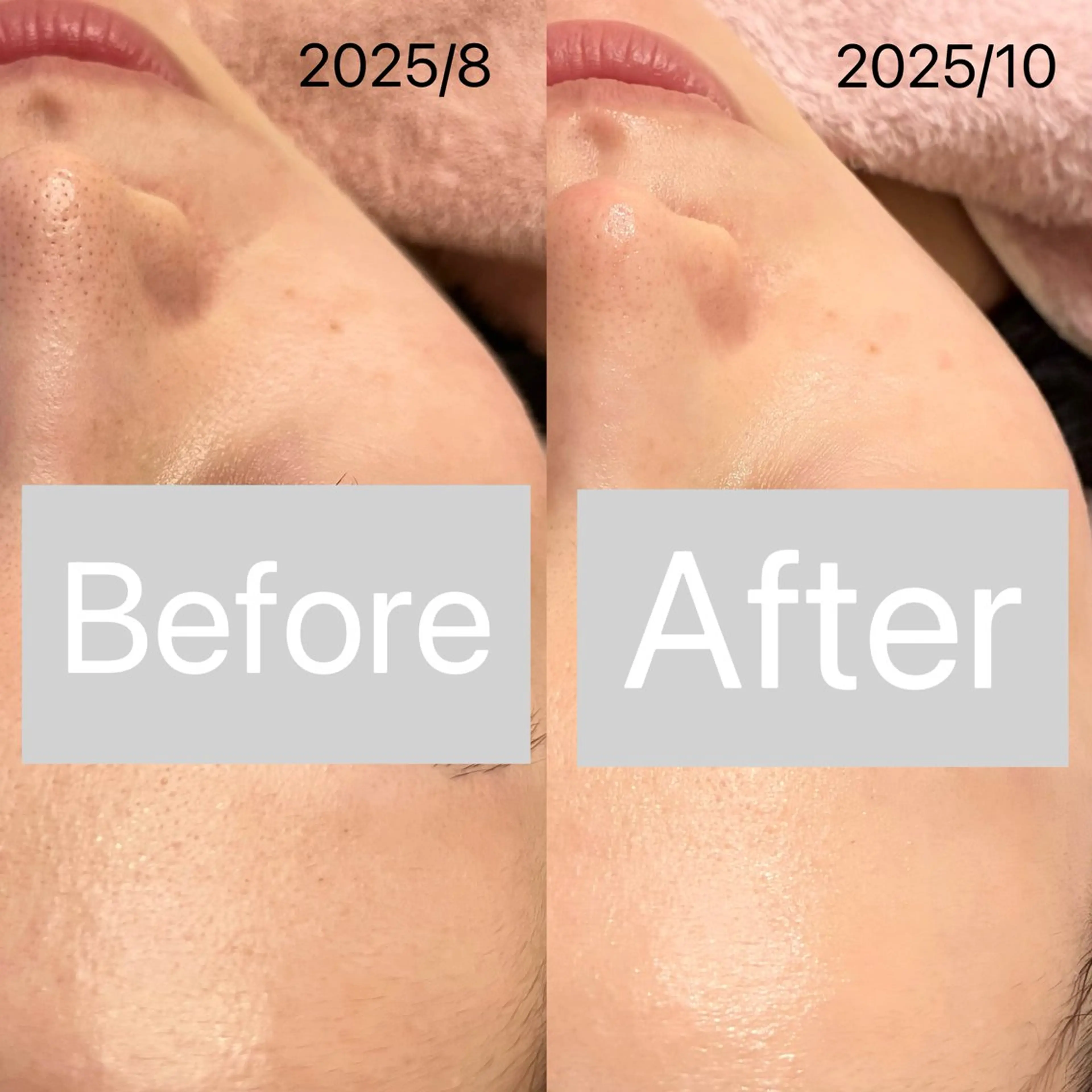 エステ アイラッシュ&エステサロンLinda西宮所属・小顔&肌質改善 LINDA西宮 AIのエステ・リラクイメージ