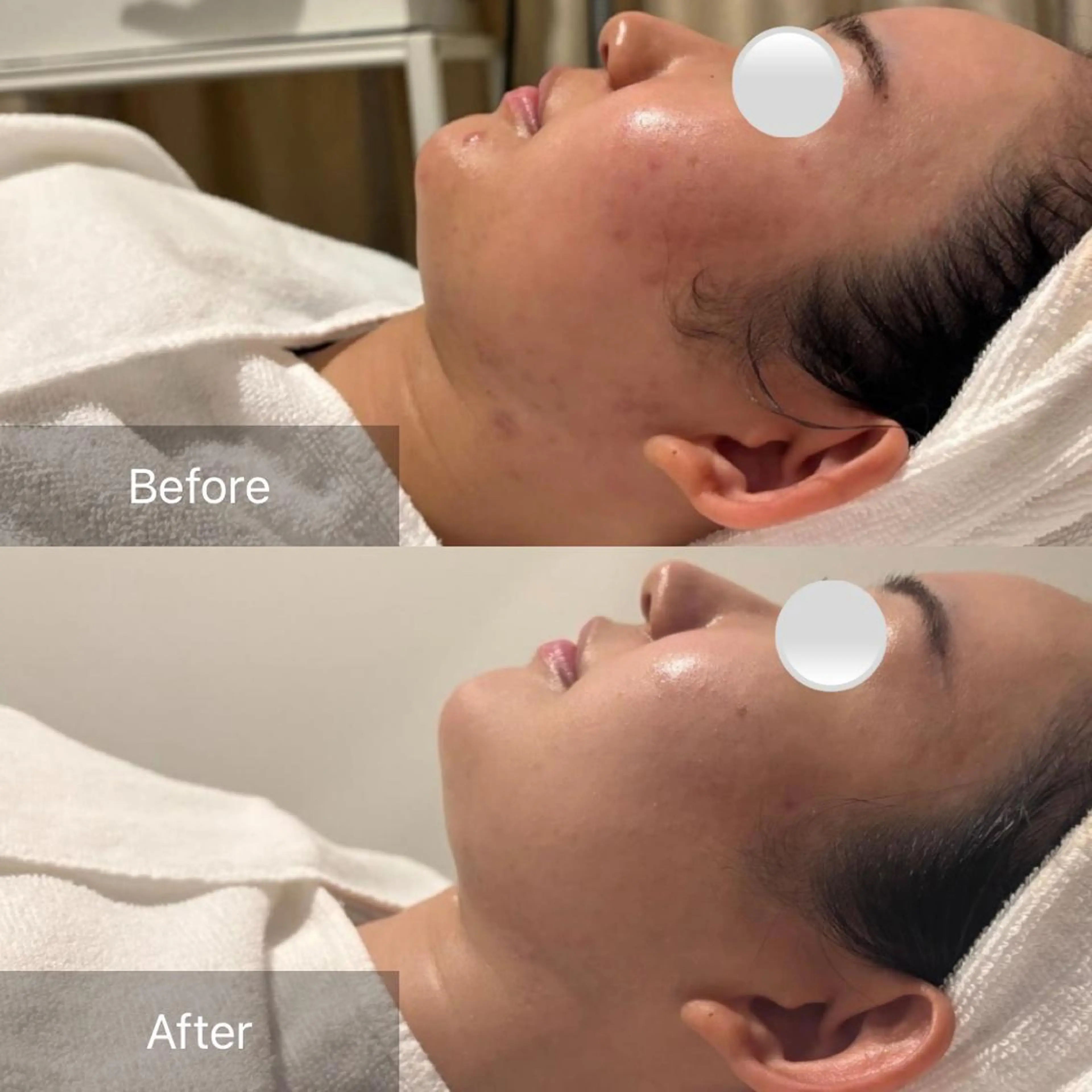 【美肌・脱毛専門店】 SARA 恵比寿店のエステ・リラクイメージ