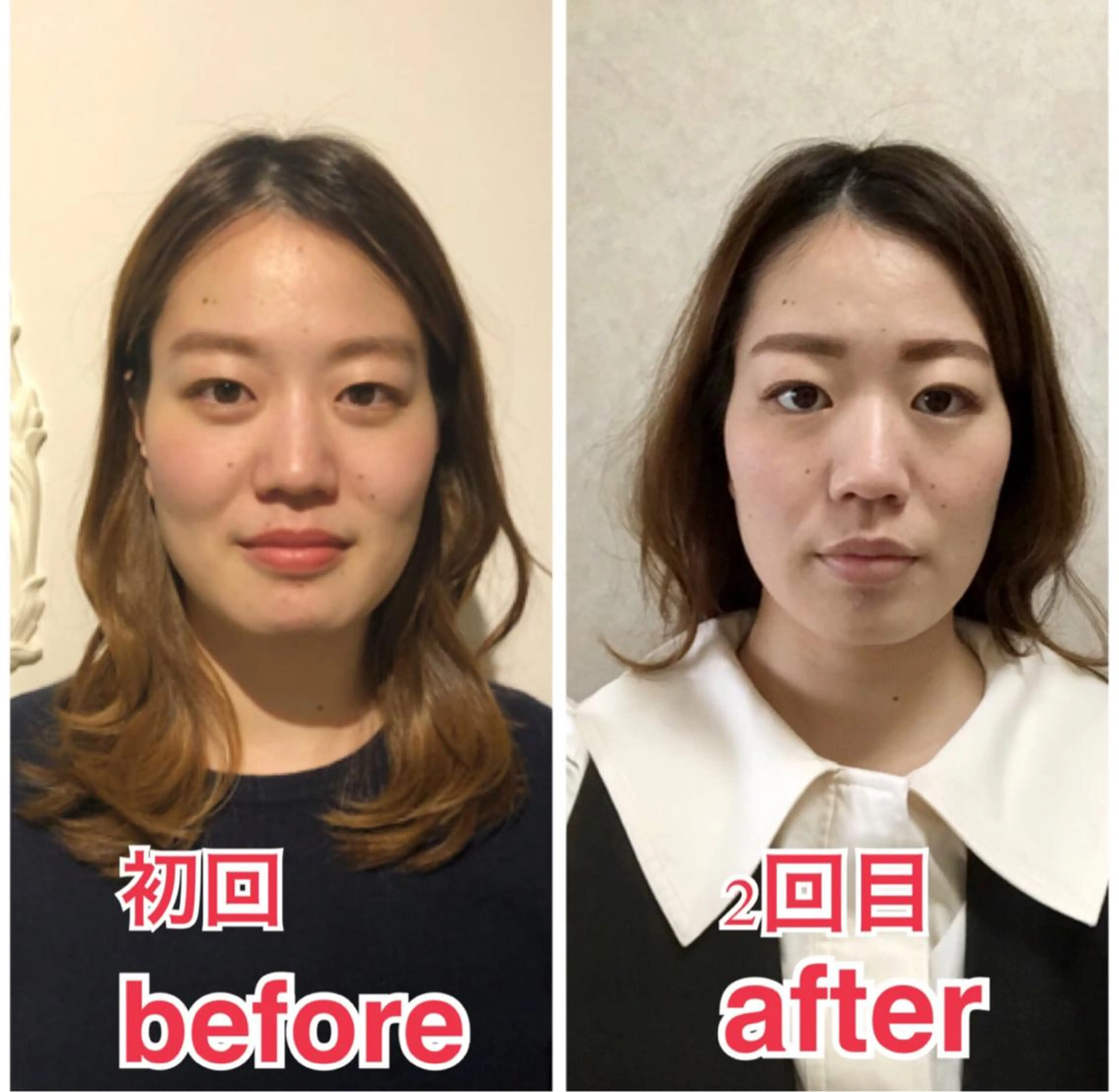 小顔矯正専門サロンジュマリ所属・町田 淳子のエステ・リラクイメージ