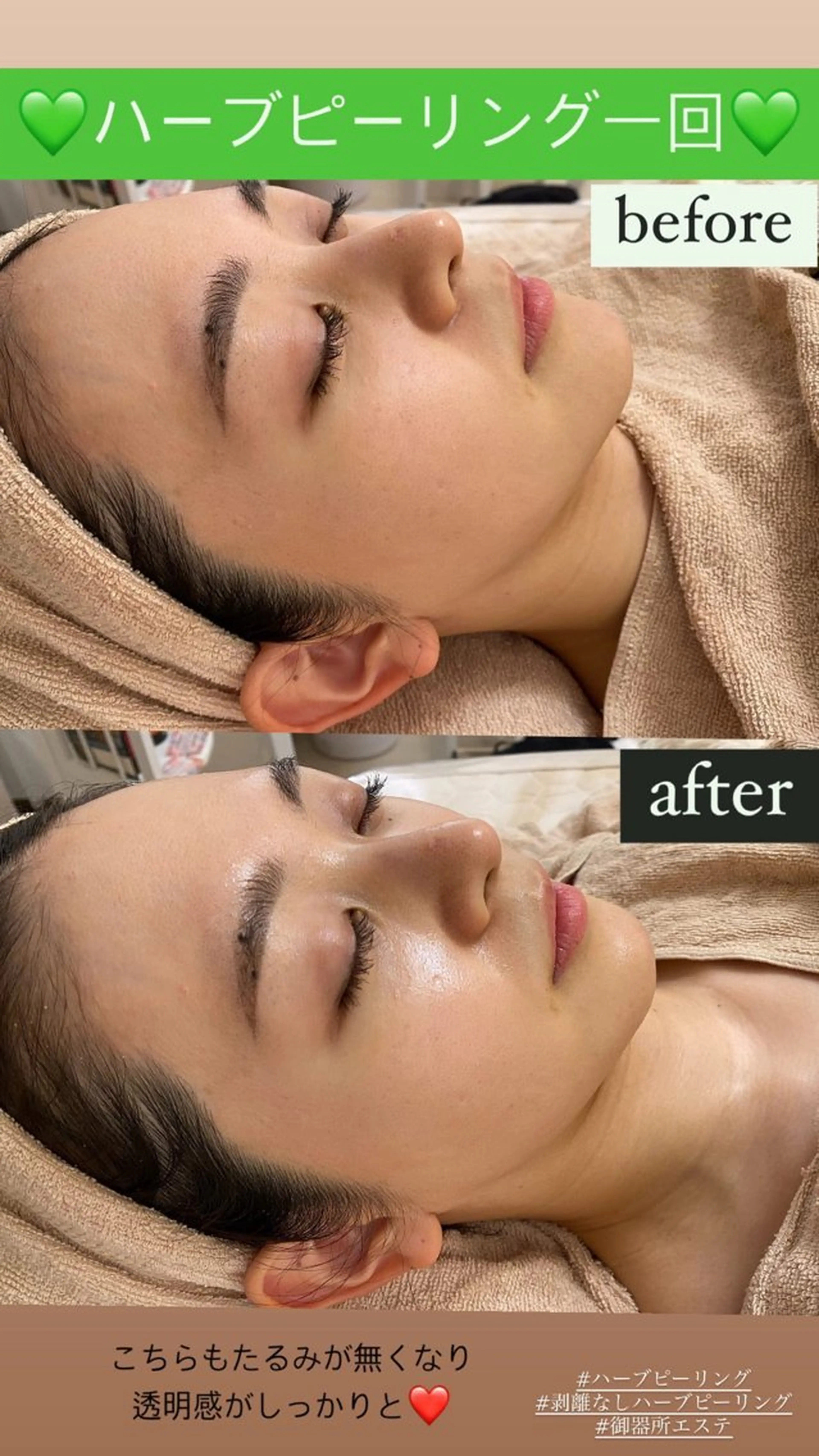 エステ Salon de Lino 御器所のエステ・リラクイメージ