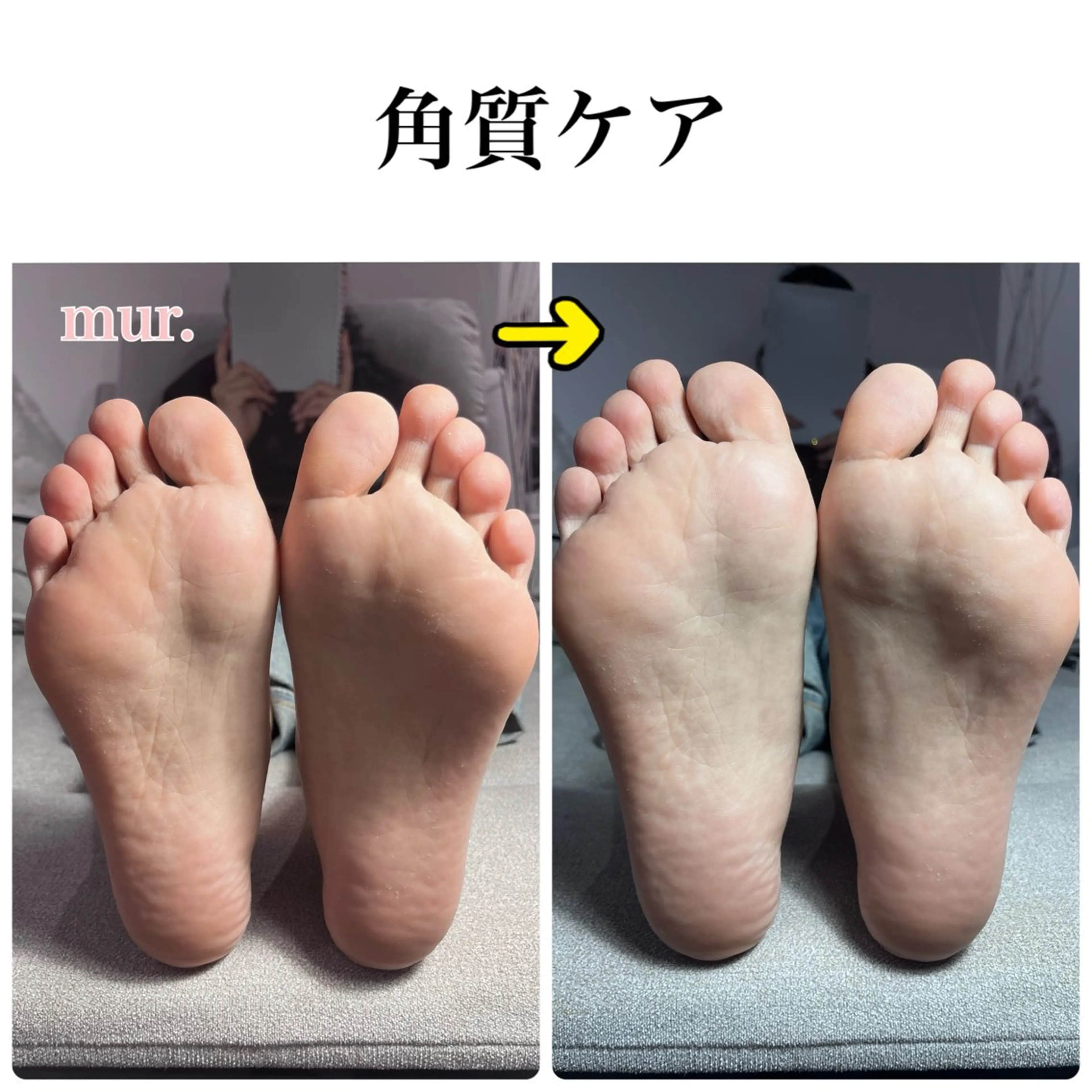 Jr.フット角質ケア☆現金払いのみの写真