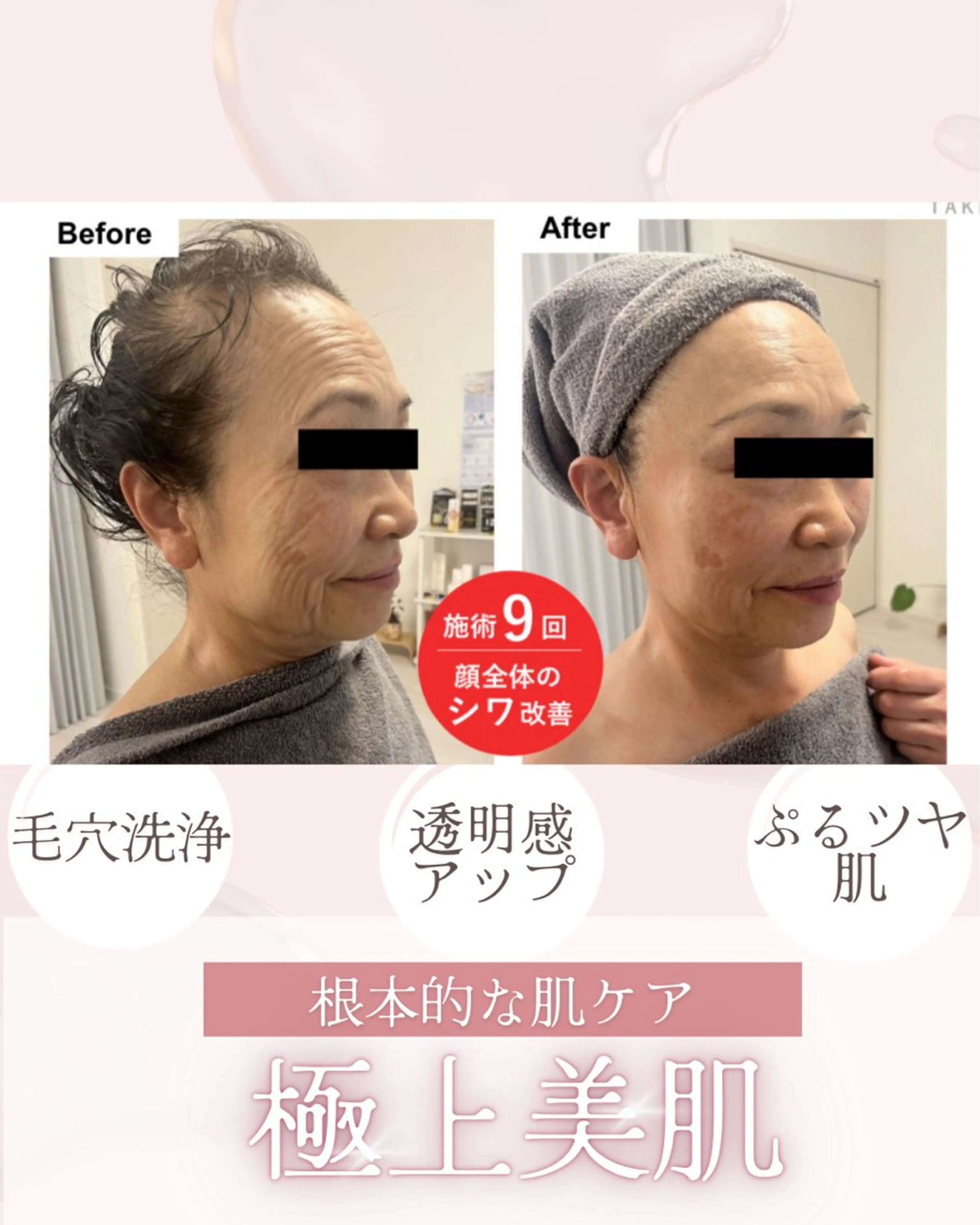 その他 akua...痩身・ 脱毛・ホワイトニングのその他イメージ