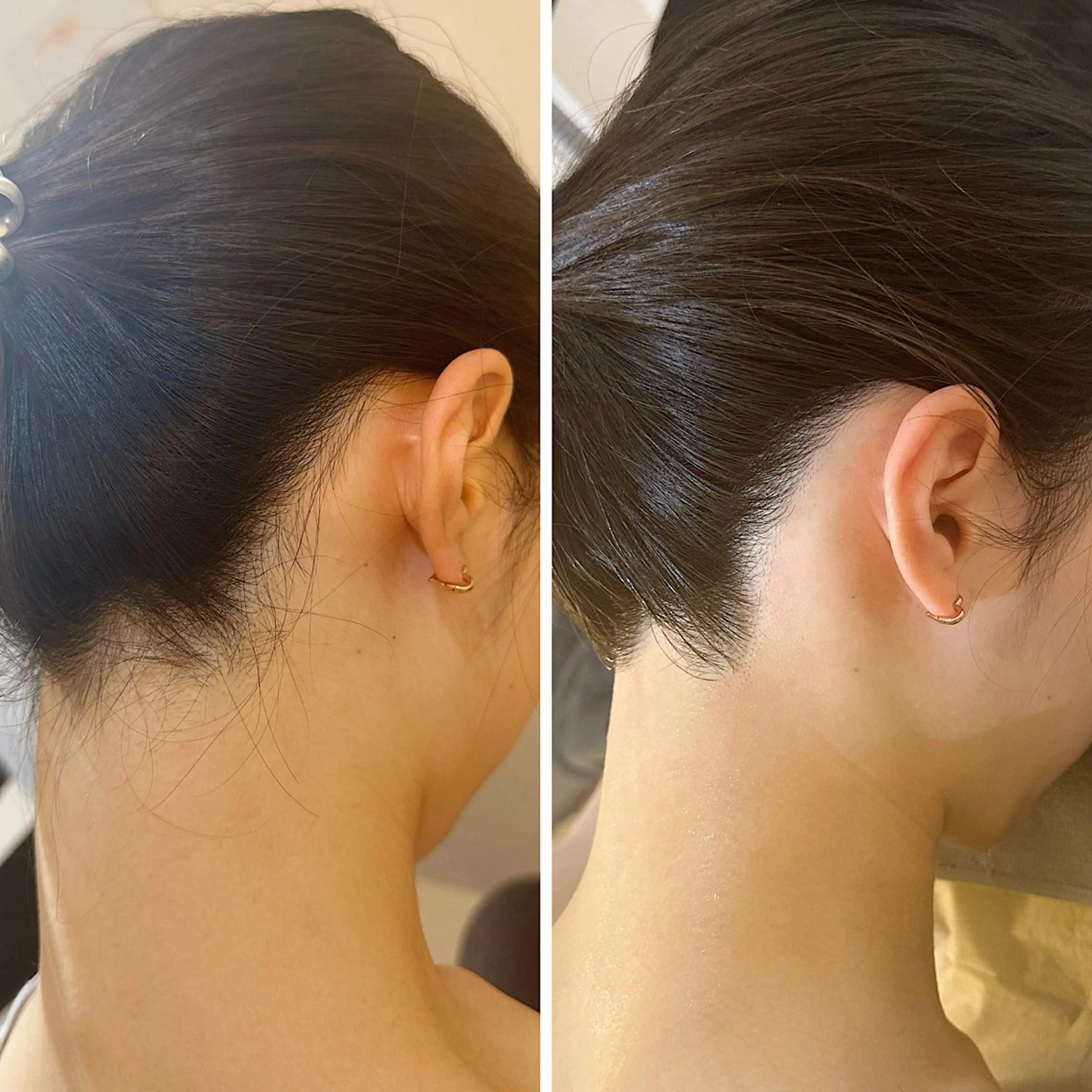 脱毛 うなじ脱毛/美肌脱毛 LABELのエステ・リラクイメージ