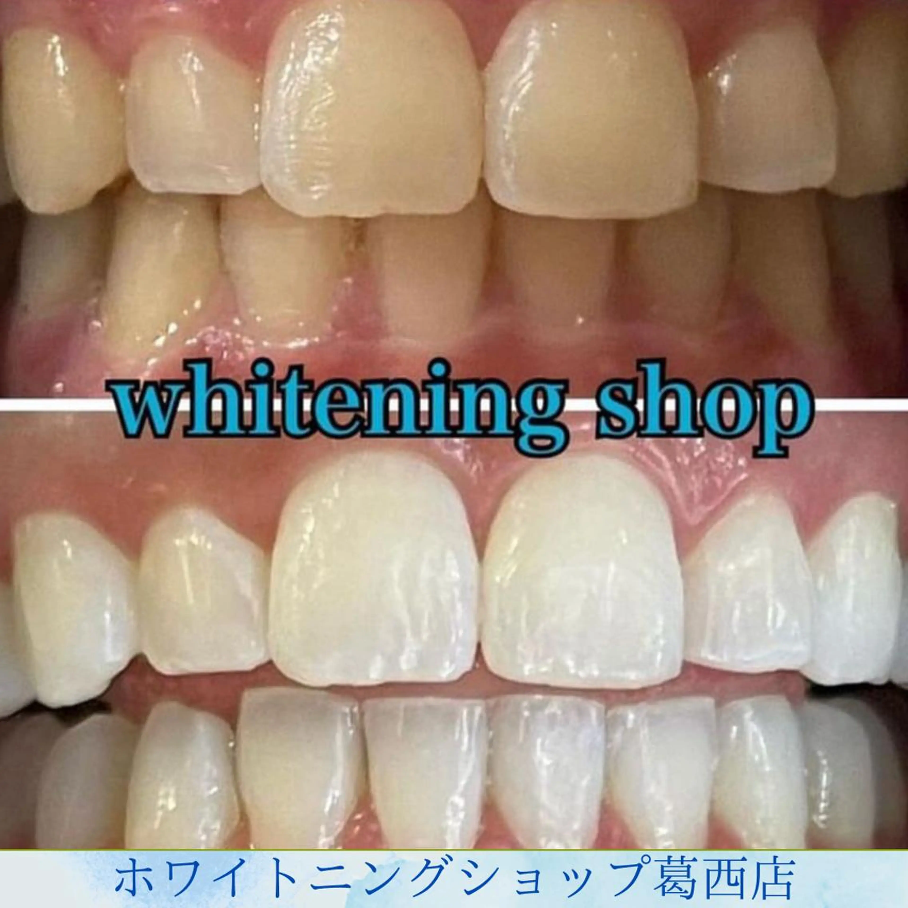 その他 ホワイトニング ショップ葛西店のその他イメージ