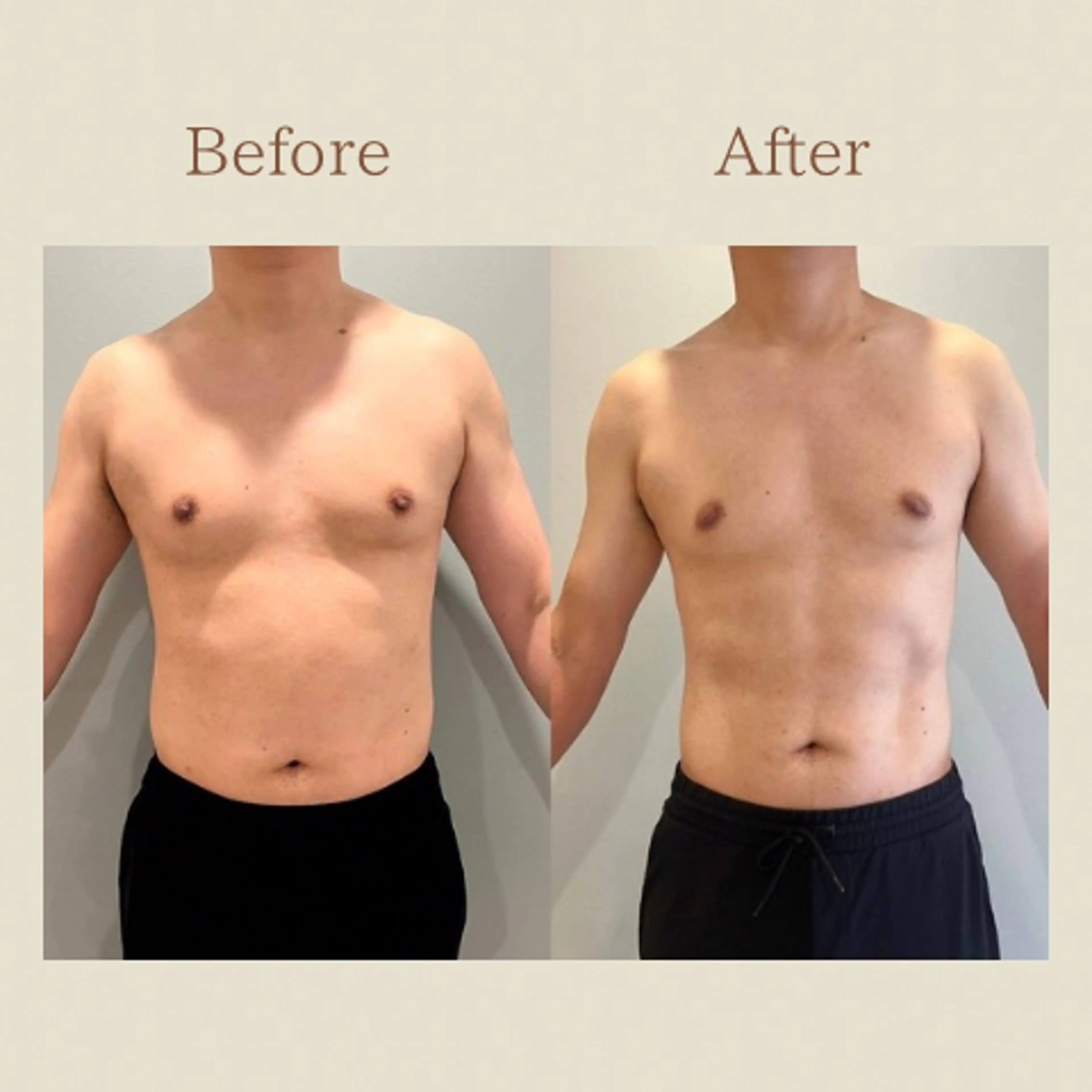 お腹痩せエステ Flat BELLY 恵比寿所属・【腸もみ/脂肪冷却】 お腹エステ/恵比寿のエステ・リラクイメージ