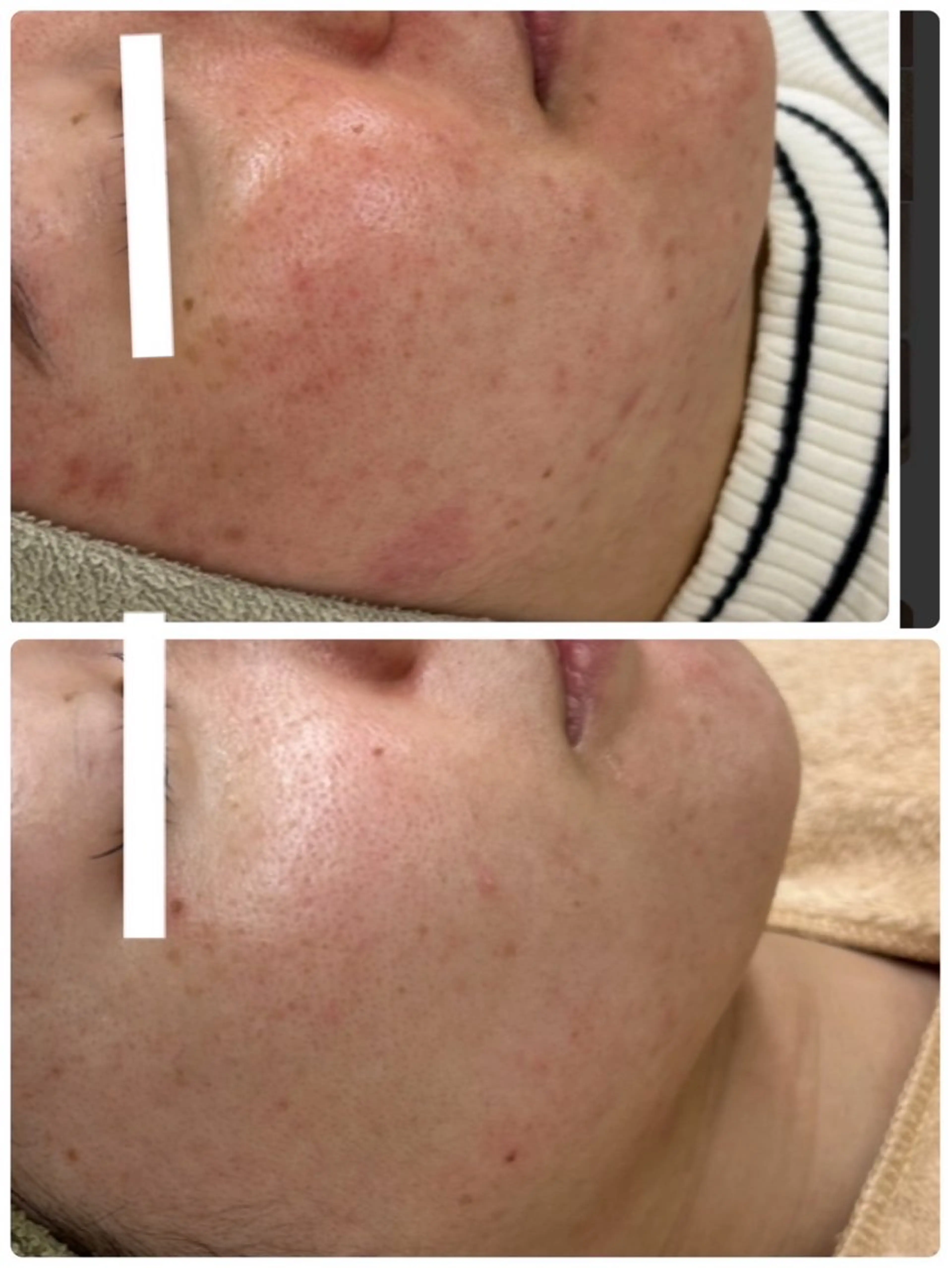 Grandir所属・ハーブピーリング専門 グランディール　武内のエステ・リラクイメージ