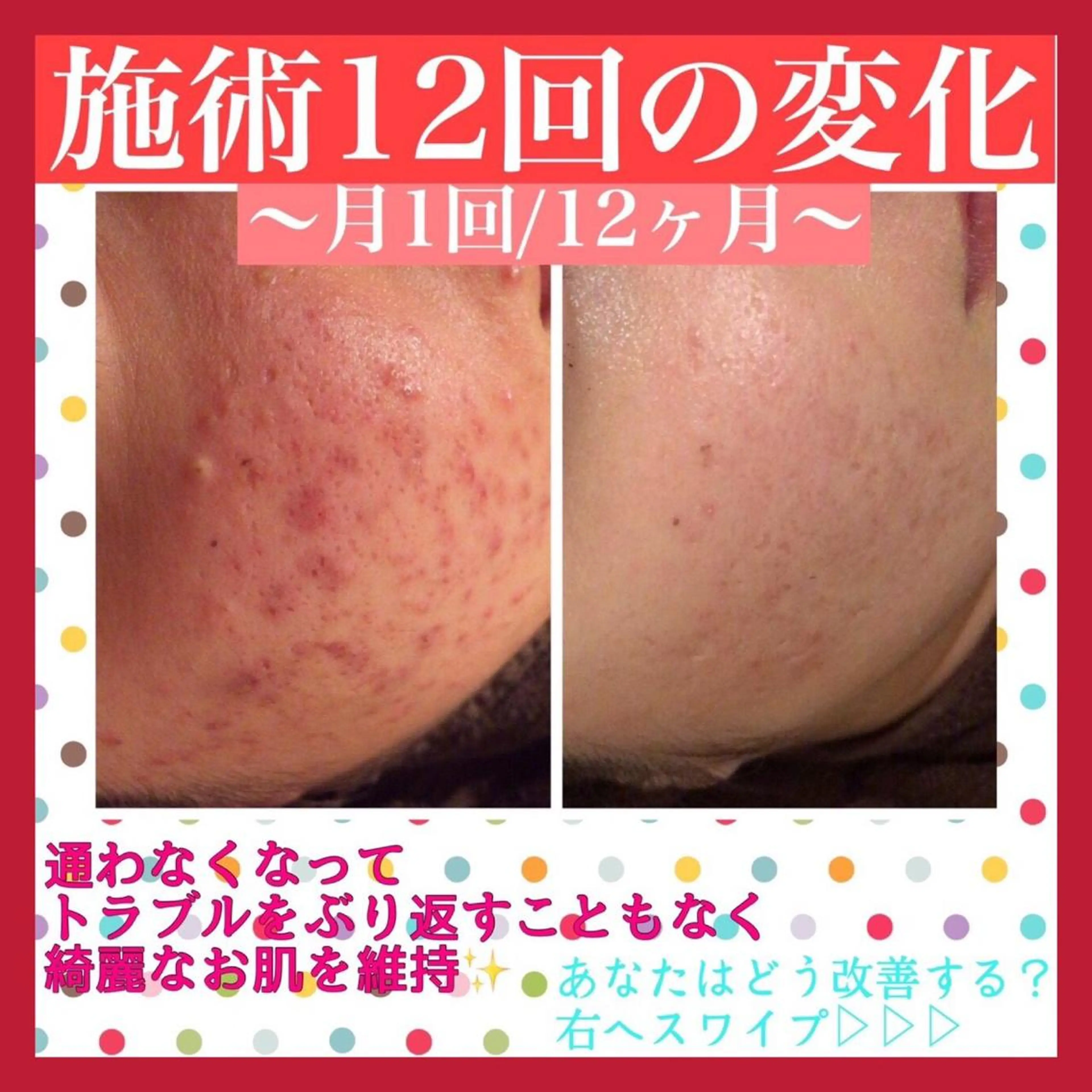 ミディアム カラー パーマ ヘアアレンジ メンズ キッズ ネイル マツエク・マツパ アイブロウ エステ リラク アクール　齋藤 ♡肌トラブル卒業のエステ・リラクイメージ