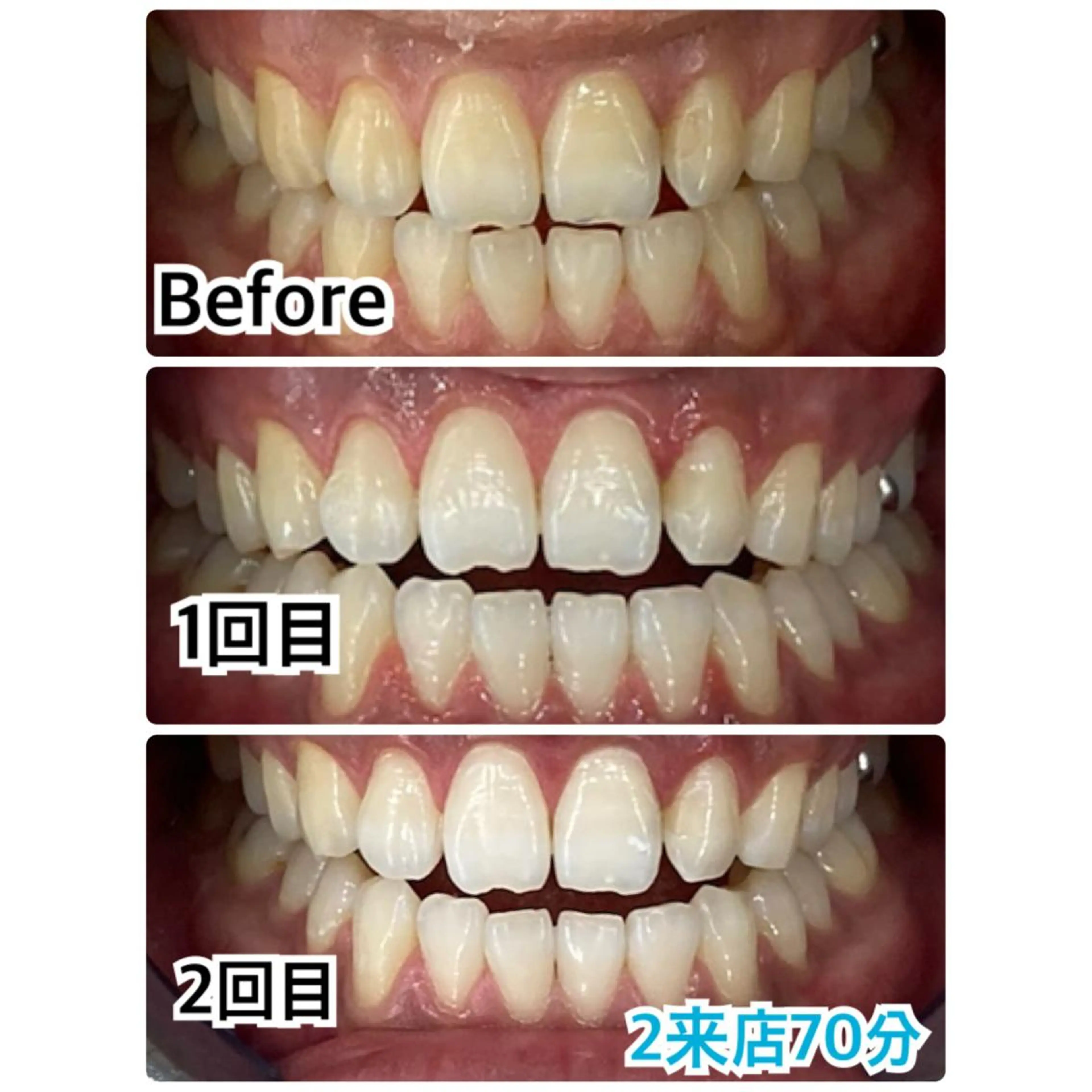 プラチナムビューティー柏所属・【歯科連携】柏ホワイ トニング専門店のその他イメージ