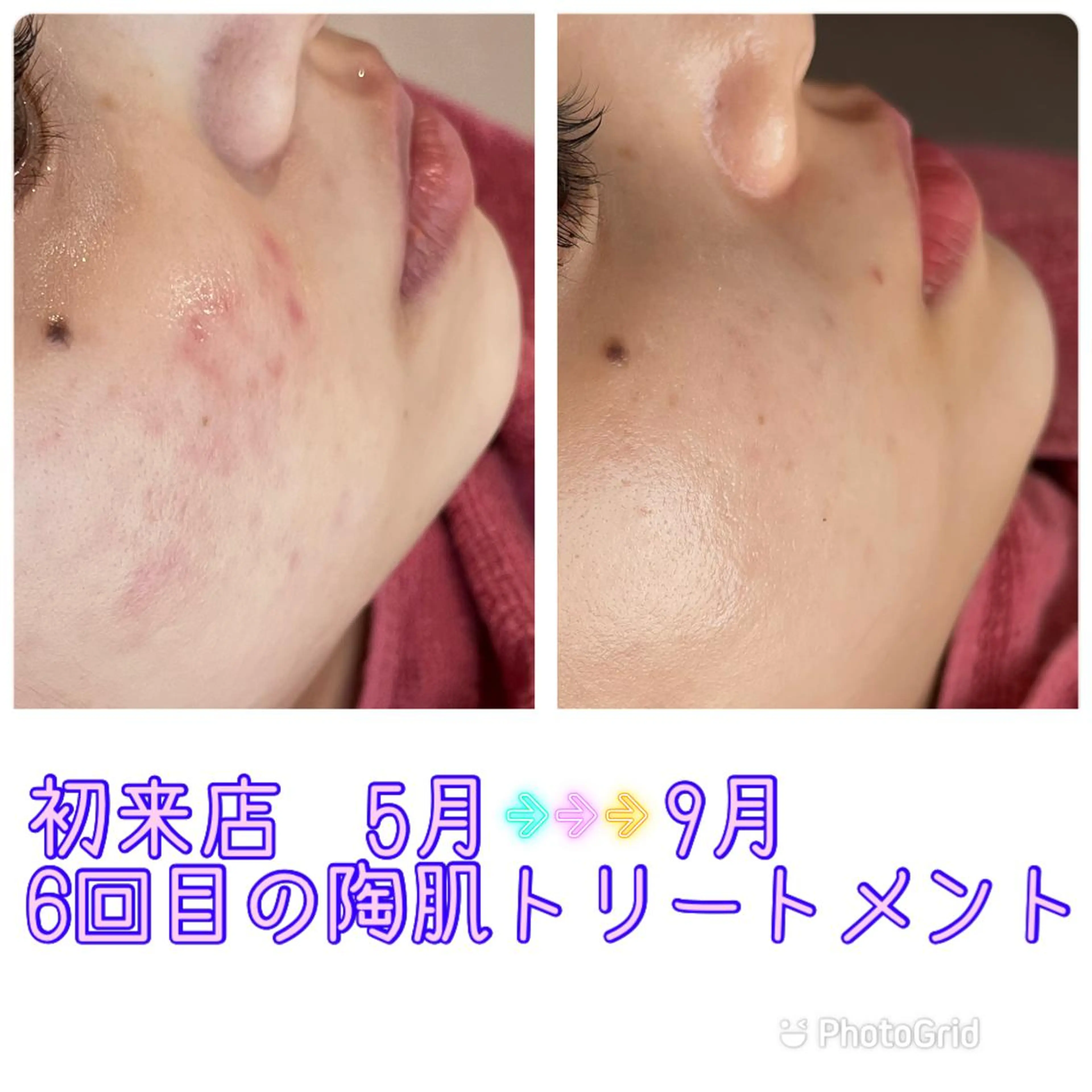 エステ Dione八王子店所属・Dione 八王子店のエステ・リラクイメージ