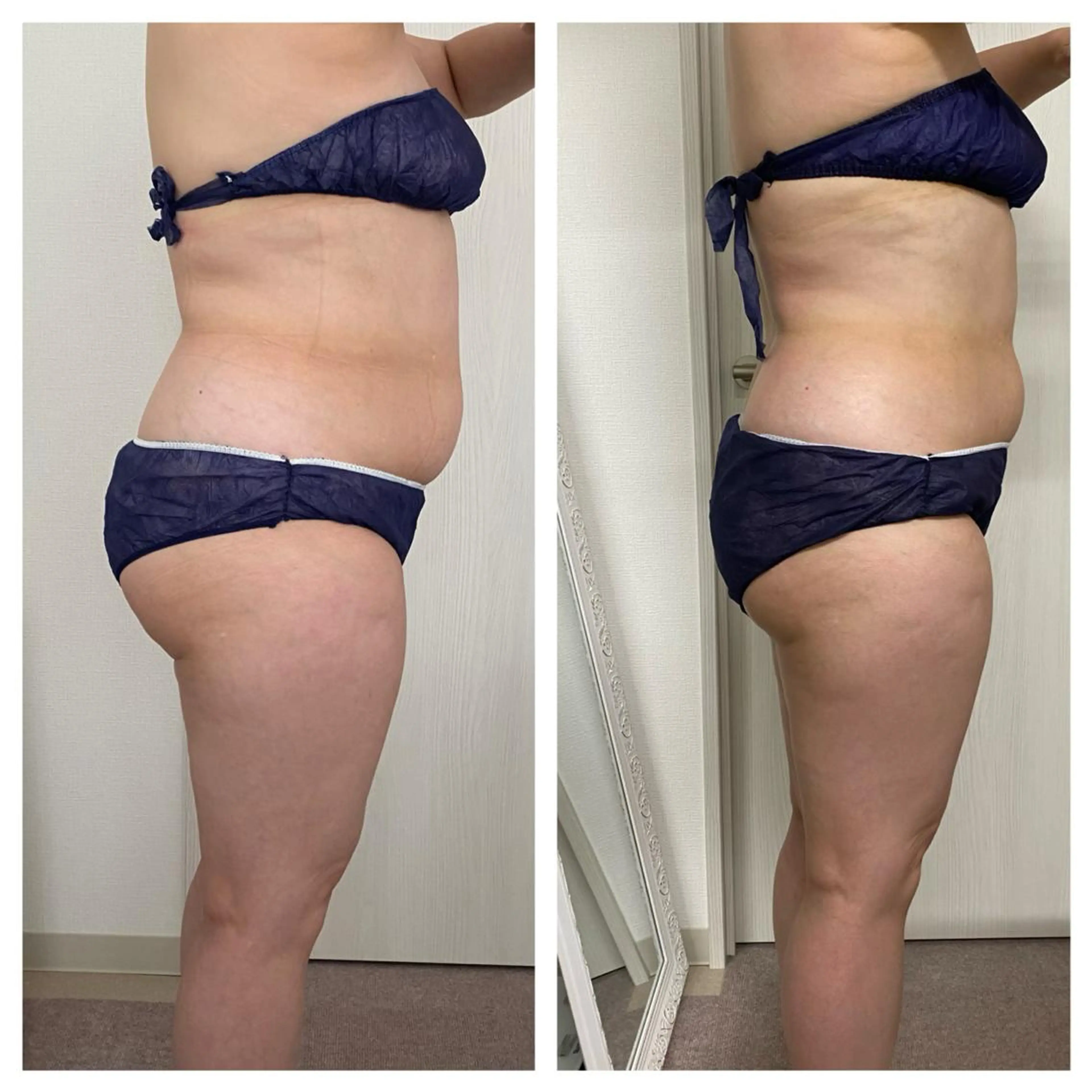 エステ 武藤 千裕のエステ・リラクイメージ