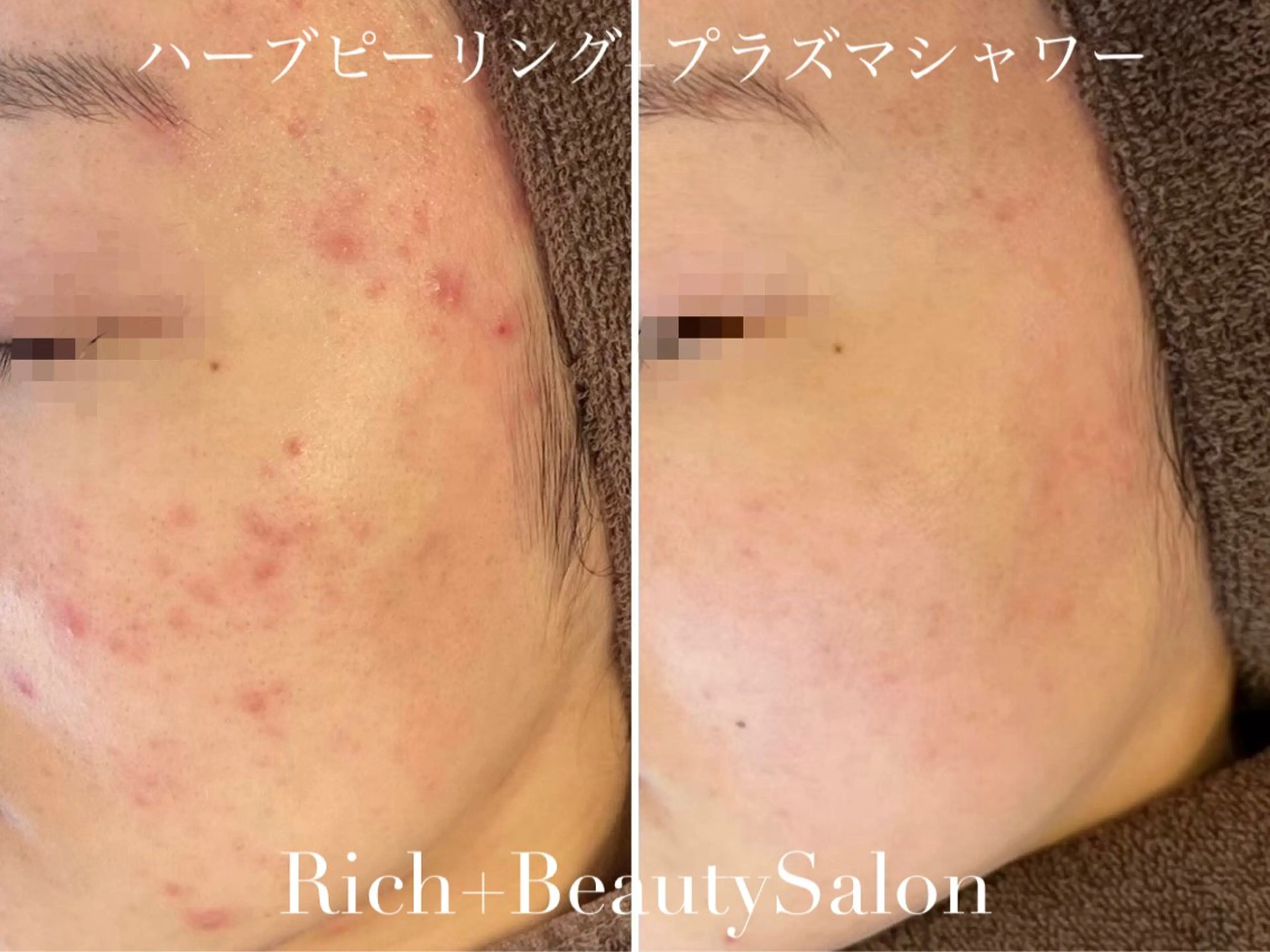 エステ Rich+ ビューティーサロンのエステ・リラクイメージ