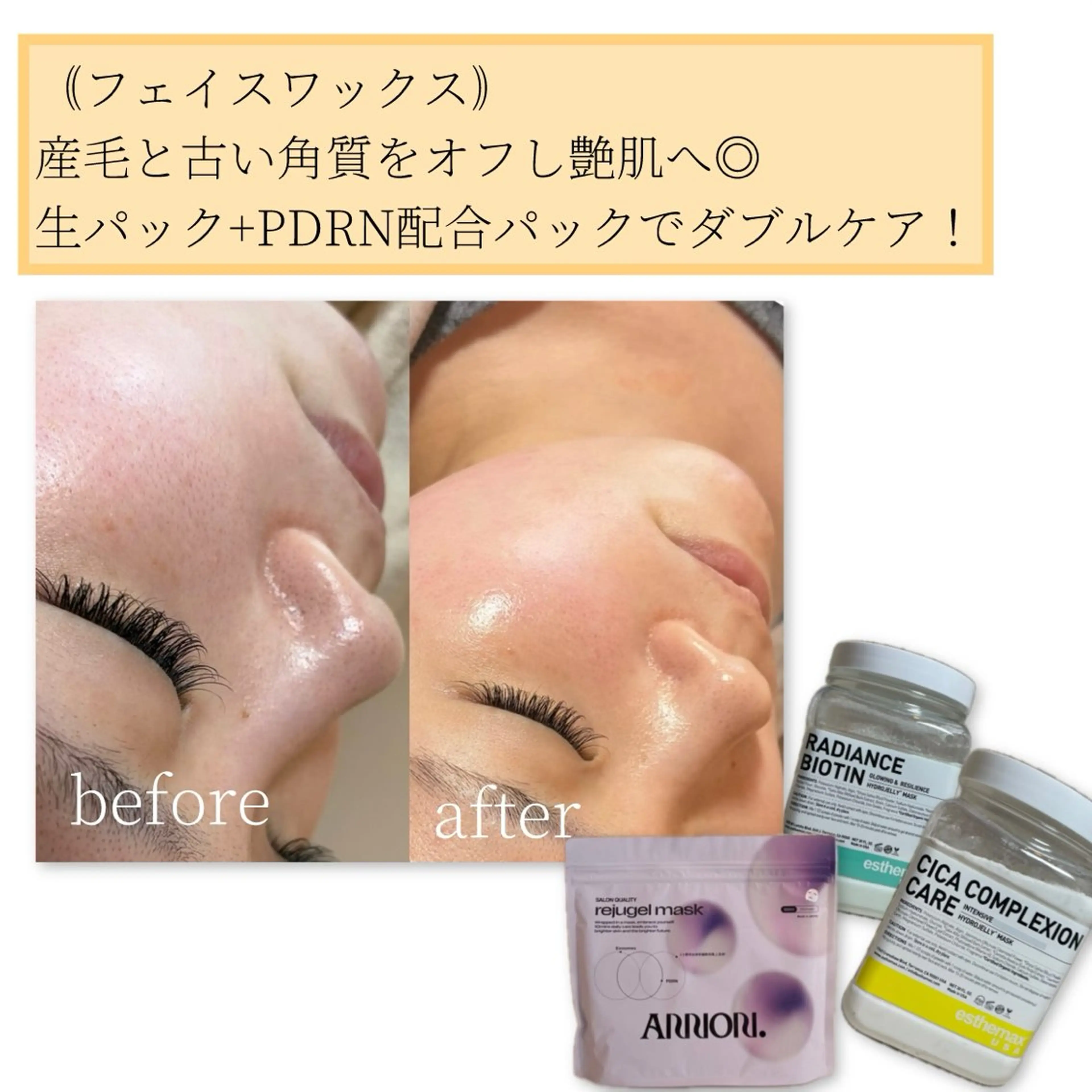 脱毛 Erika komorebi_のエステ・リラクイメージ