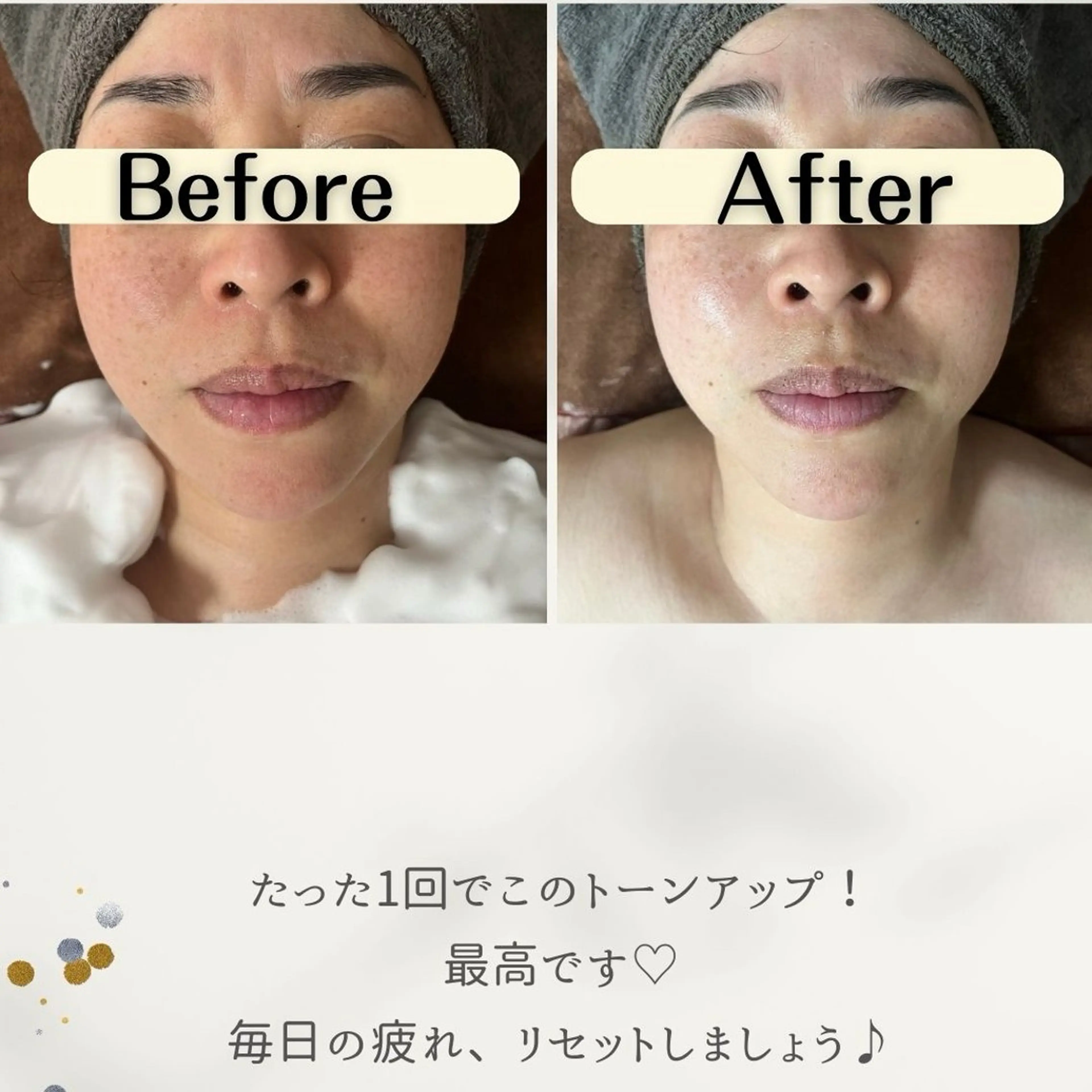 お肌と歯のサロン　Sona Mior所属・藤井 ののみのその他イメージ