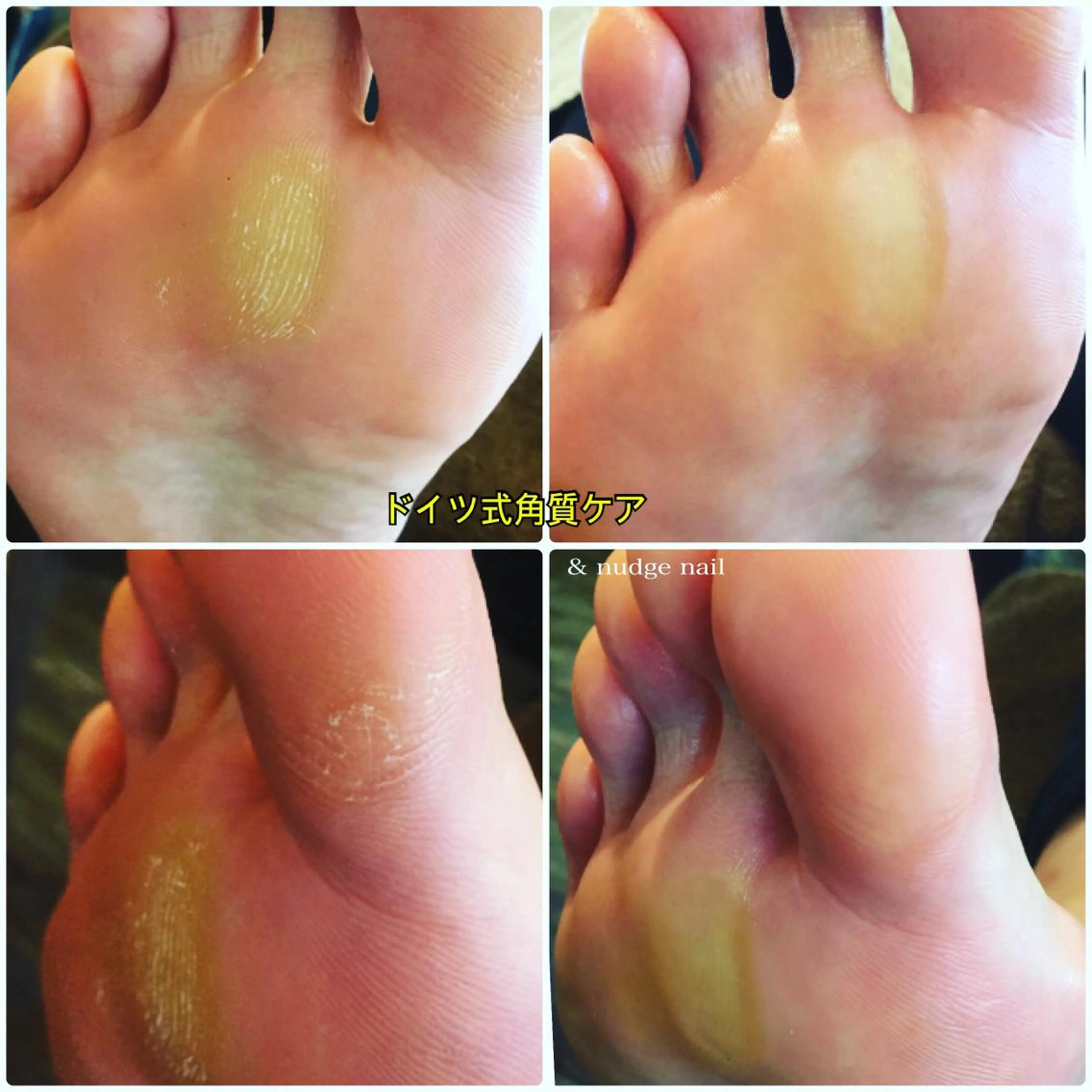 ネイル & nudge nail所属・&nudgenail 本多のネイルデザイン