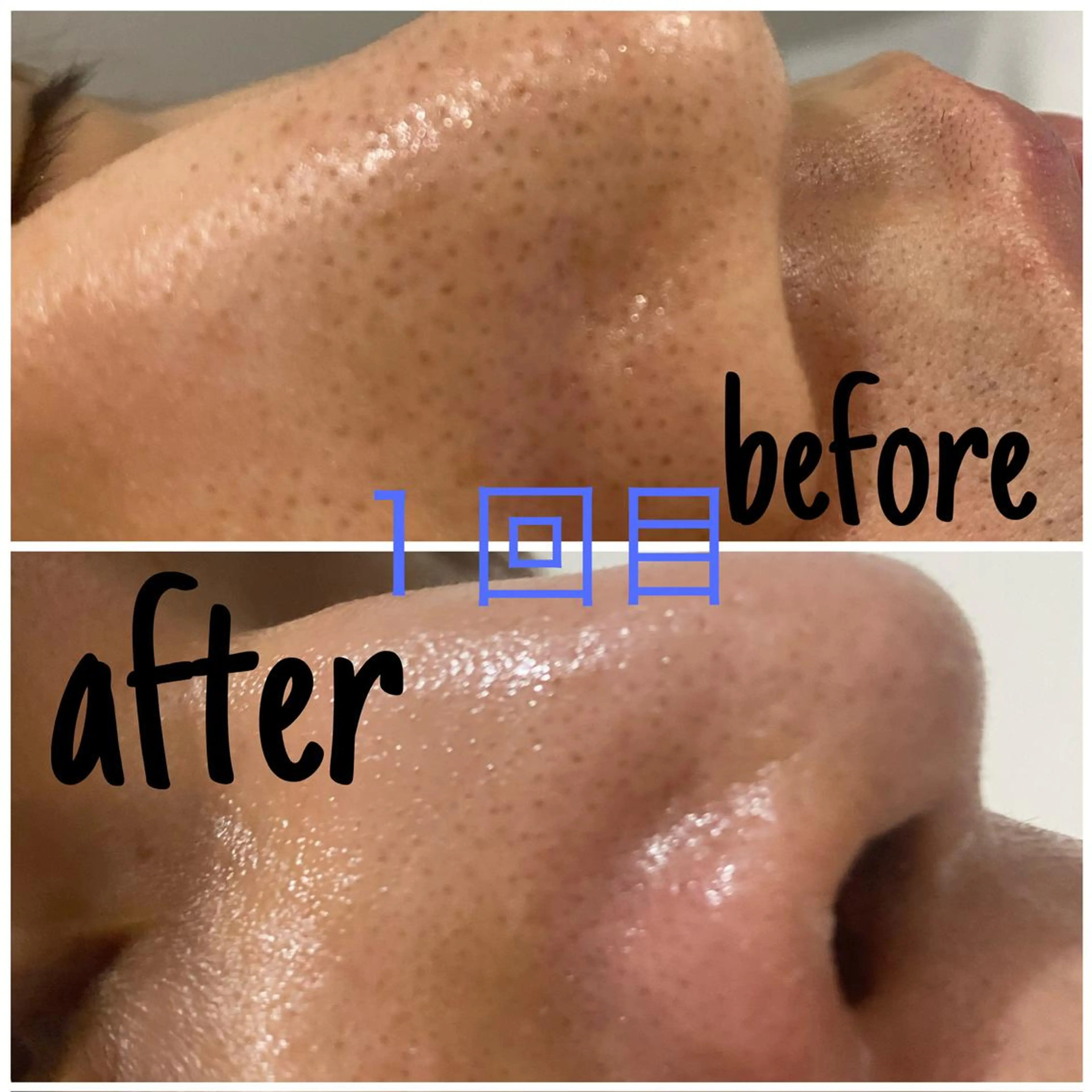 メンズ エステ アルカンジュ~archange~所属・痩身/毛穴洗浄/脱毛 アルカンジュのエステ・リラクイメージ