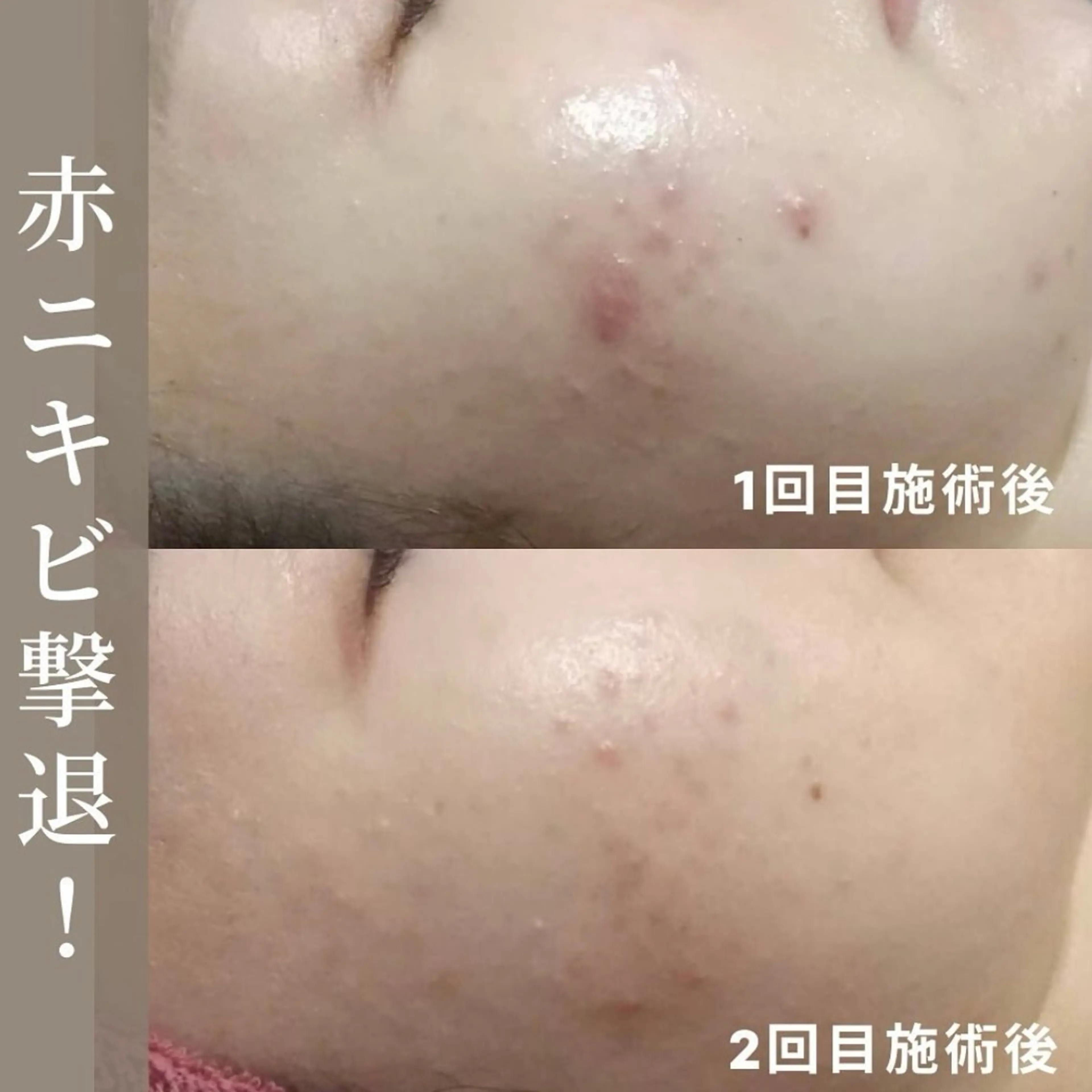 小林 千紘のエステ・リラクイメージ