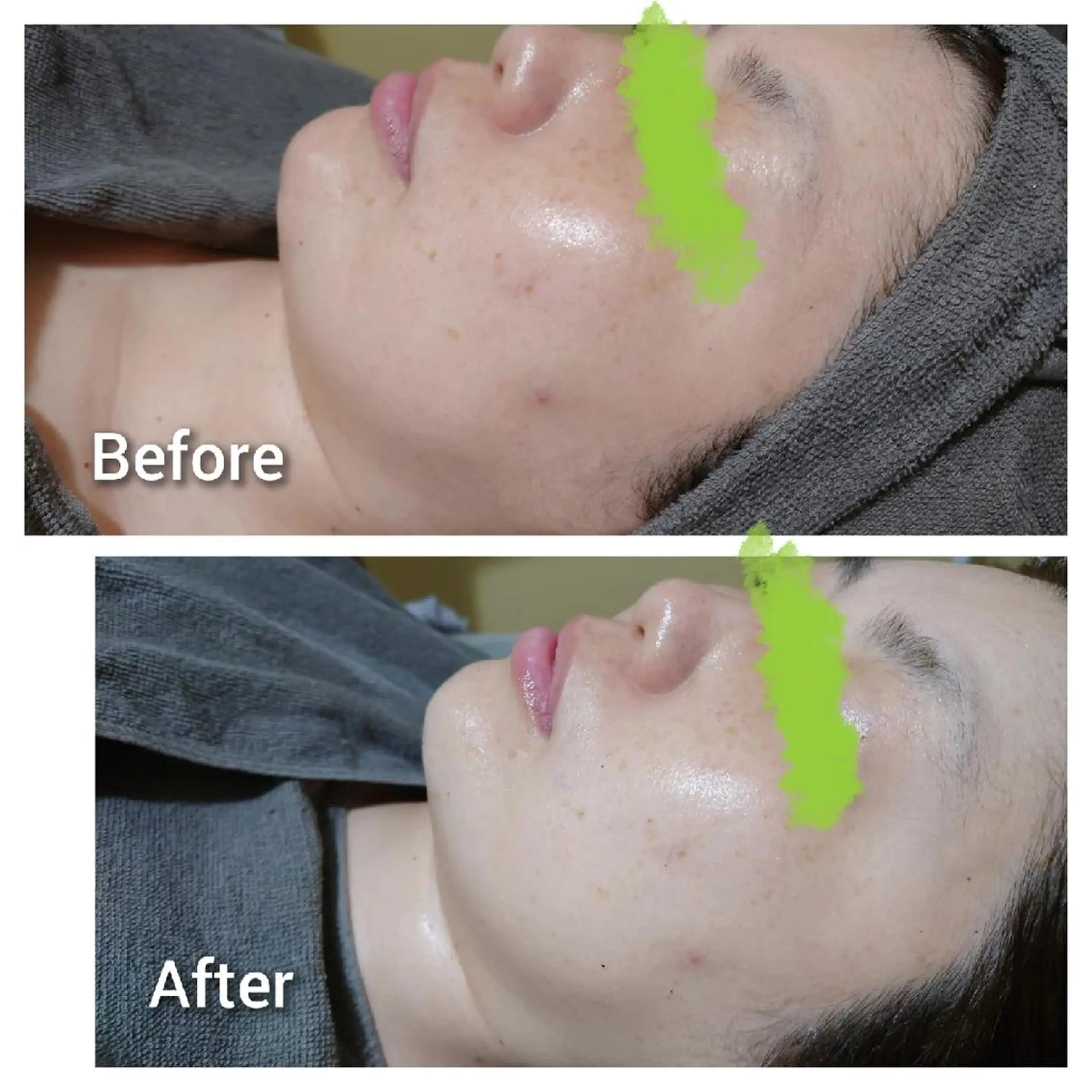 エステ Beauty Salon Luana所属・Luanaまつパ脱毛 ハーブピーリング眉毛のマツエク・マツパデザイン