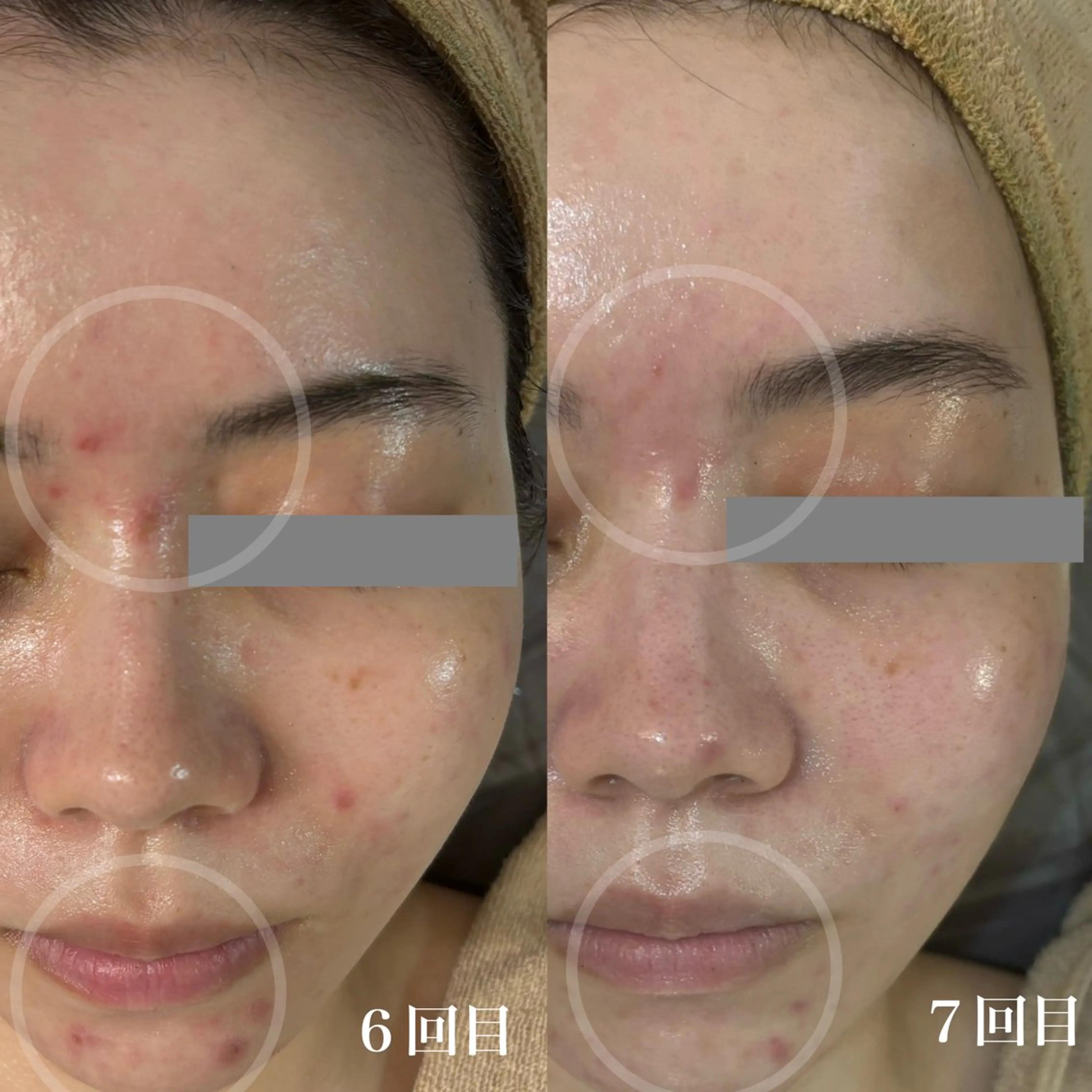 エステ WHITE AQUA 北千住店のエステ・リラクイメージ