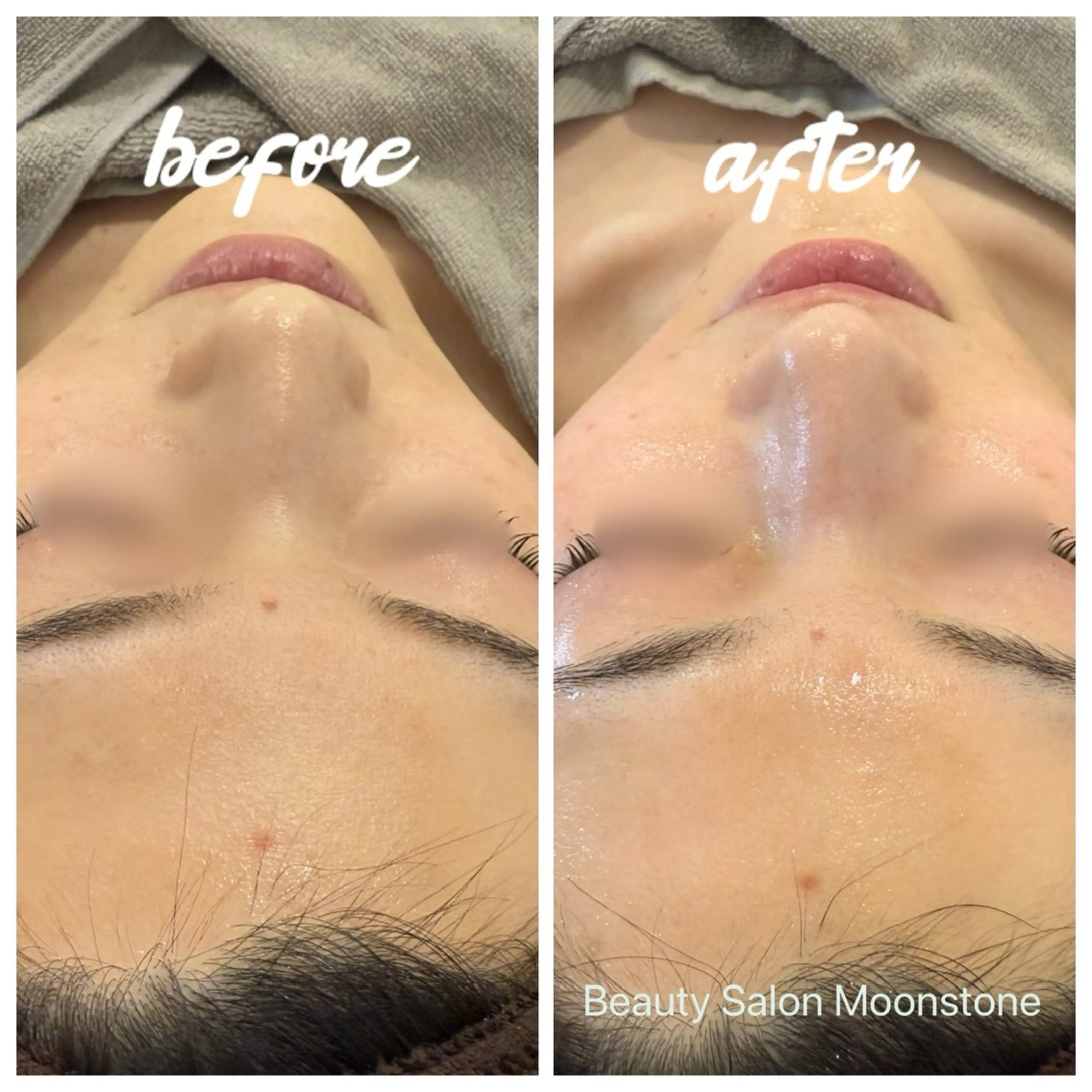 Beauty Salon Moonstone所属・Moonstone 男女•キッズ脱毛のエステ・リラクイメージ