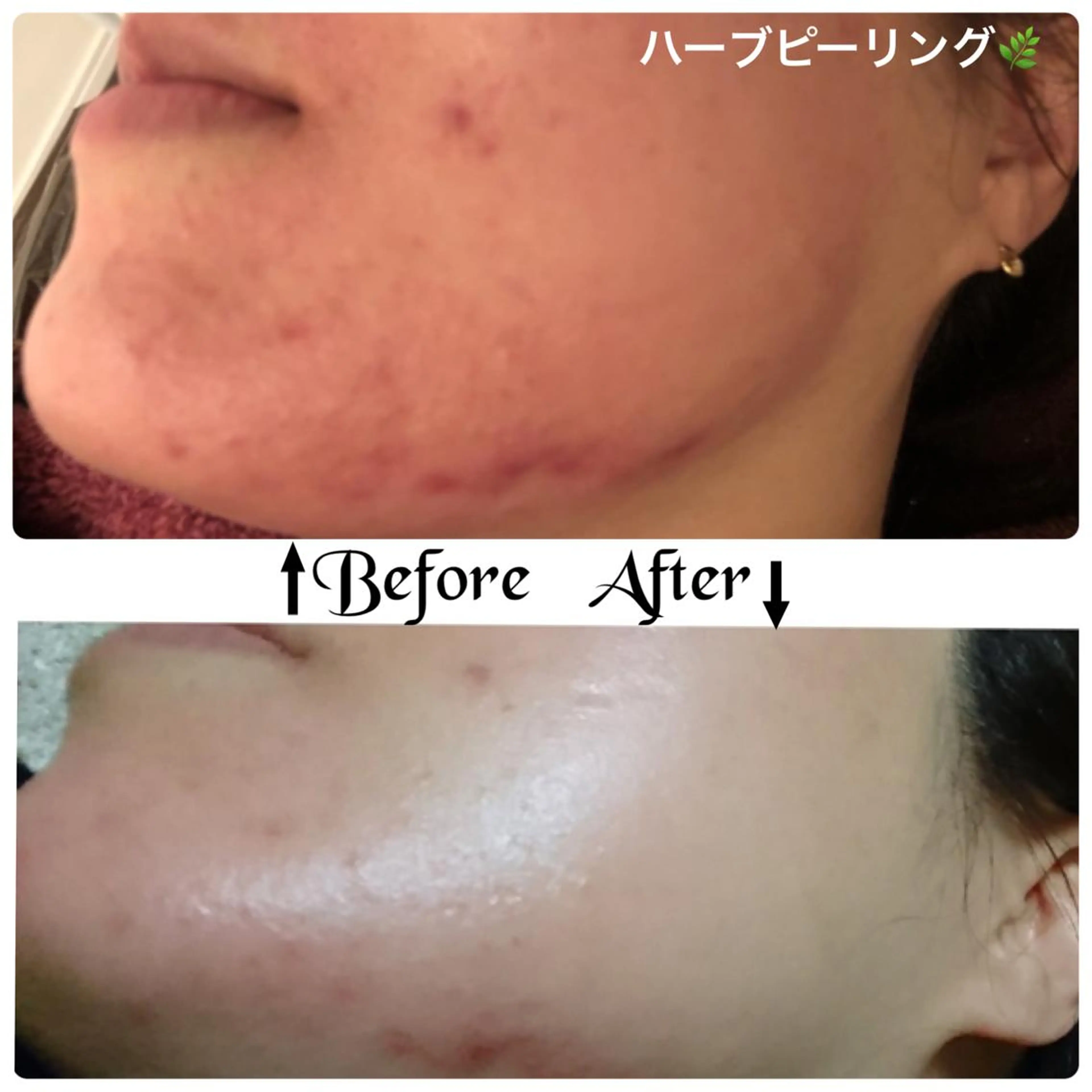 FLEUR大阪・整体 ・ハイフ・痩身・小顔のエステ・リラクイメージ