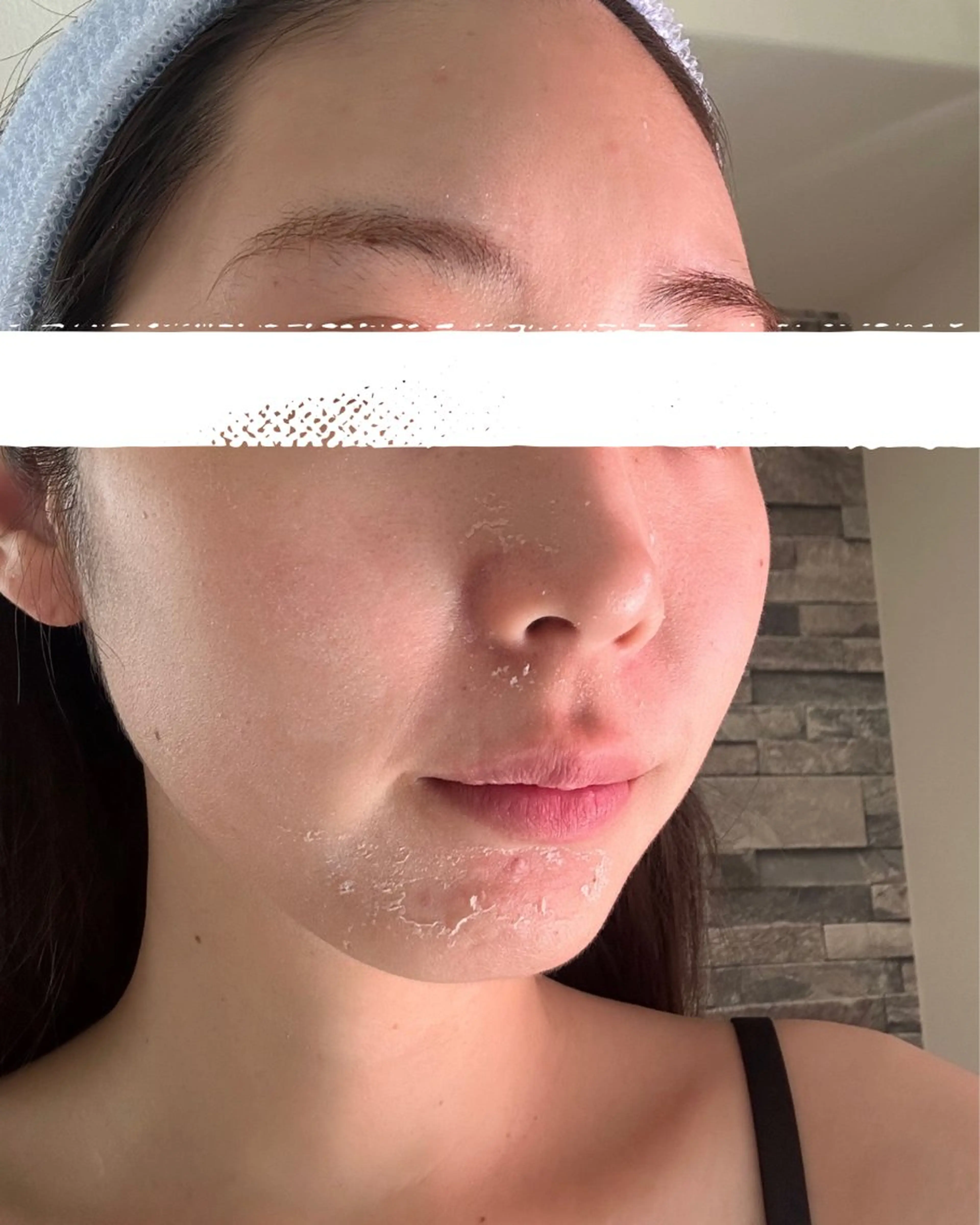 eto.所属・肌質改善サロンeto ニキビ・ニキビ跡のエステ・リラクイメージ