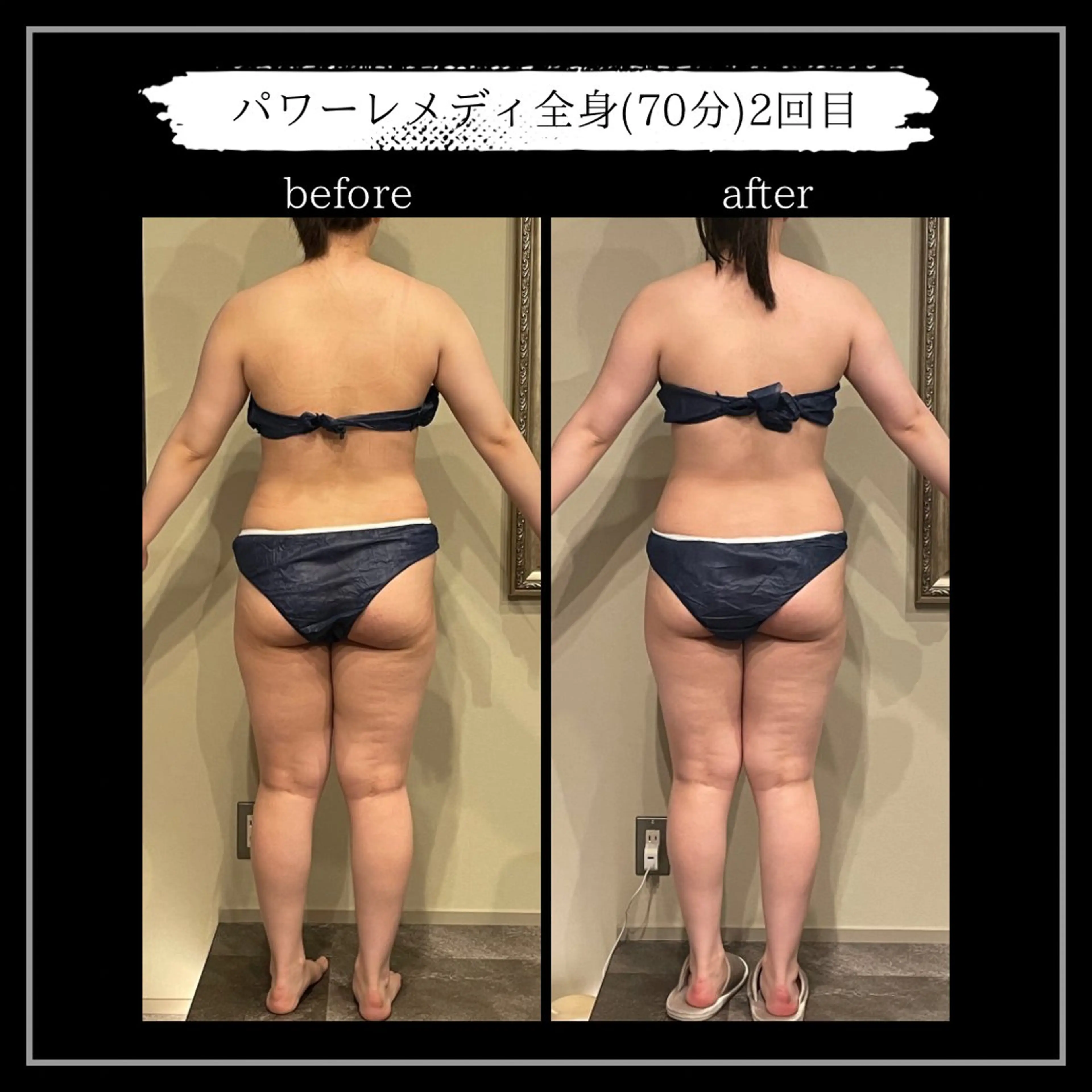 エステ リラク オフ:オン所属・オフ:オン 全身筋膜マッサージのエステ・リラクイメージ