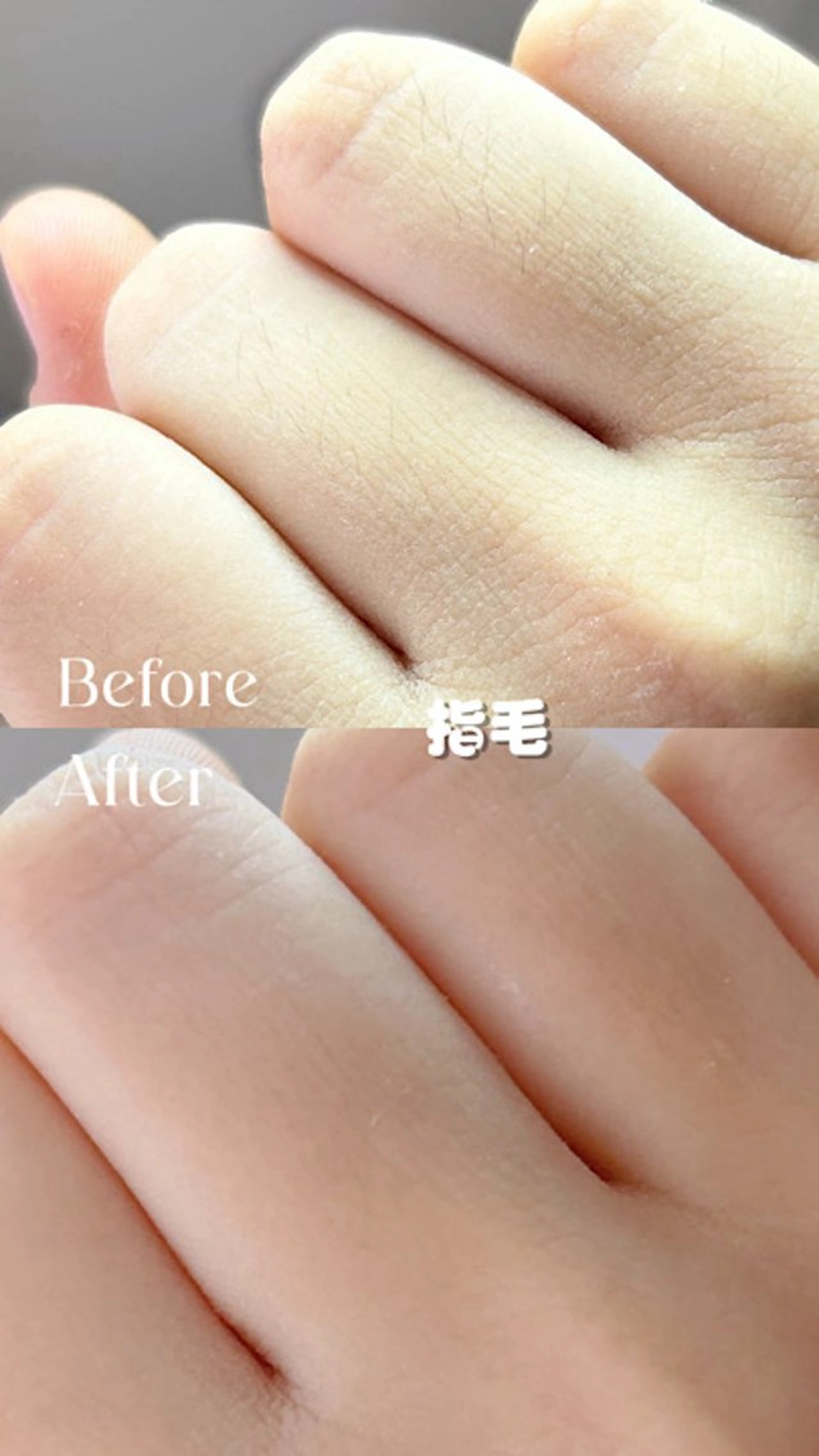 Hit. シュガーリング豊橋のエステ・リラクイメージ