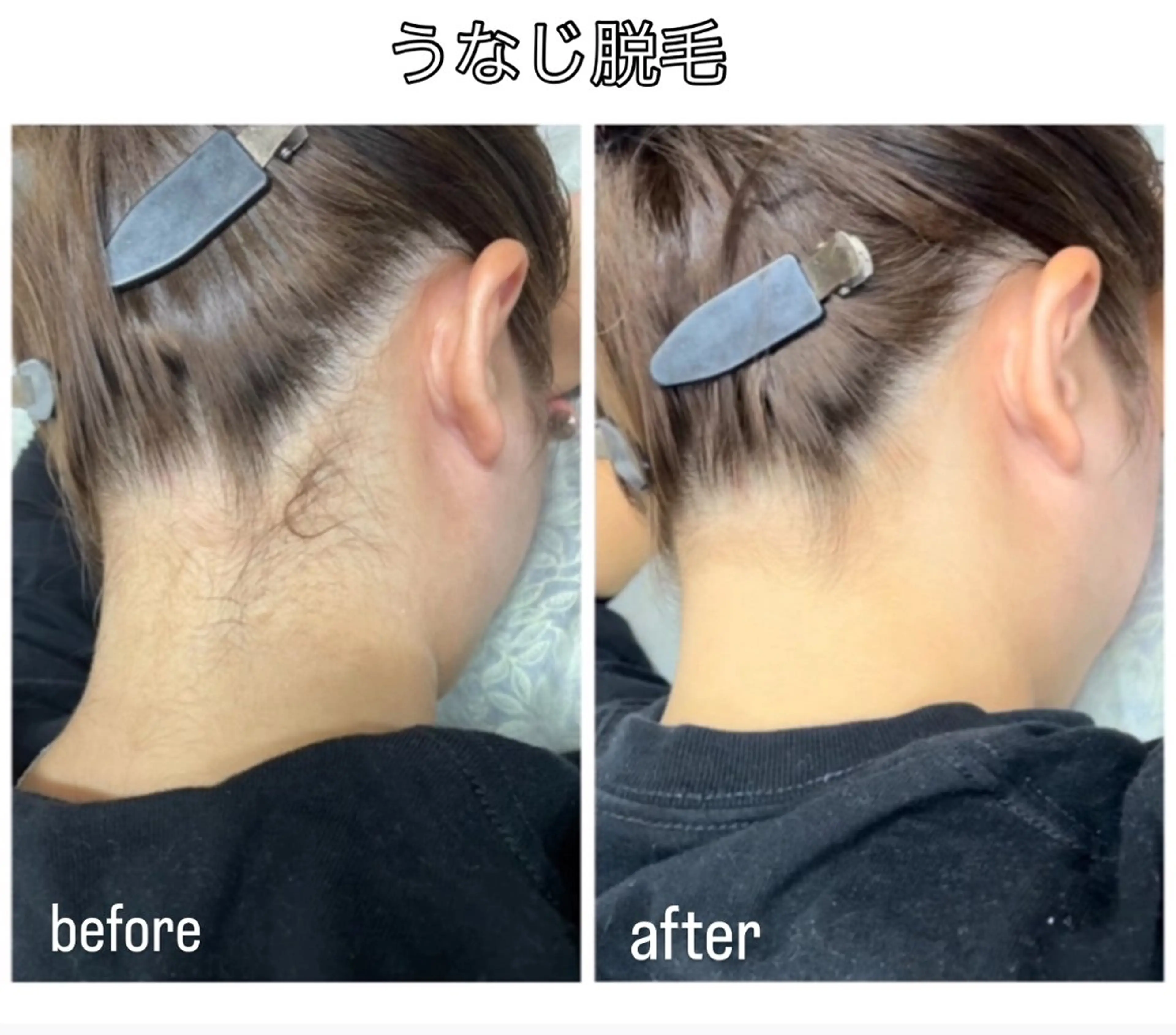 DISINI  SPA所属・DISINISPA 脱毛/フェイシャルのその他イメージ