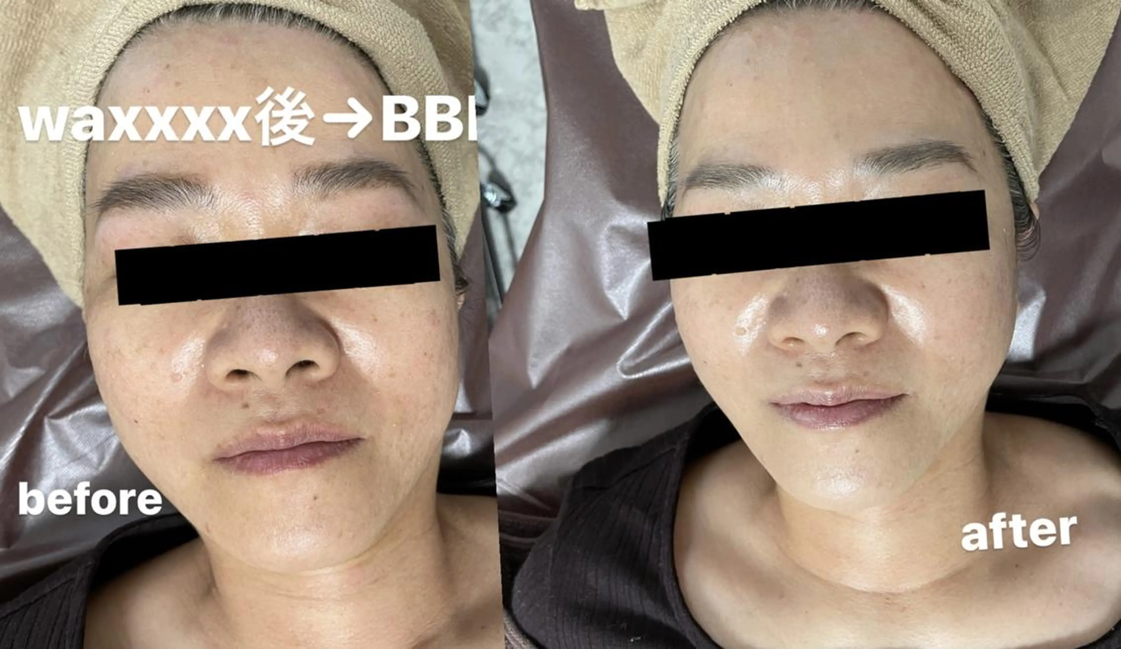 メンズ 脱毛 Epina 千葉店 【エピナ】のエステ・リラクイメージ