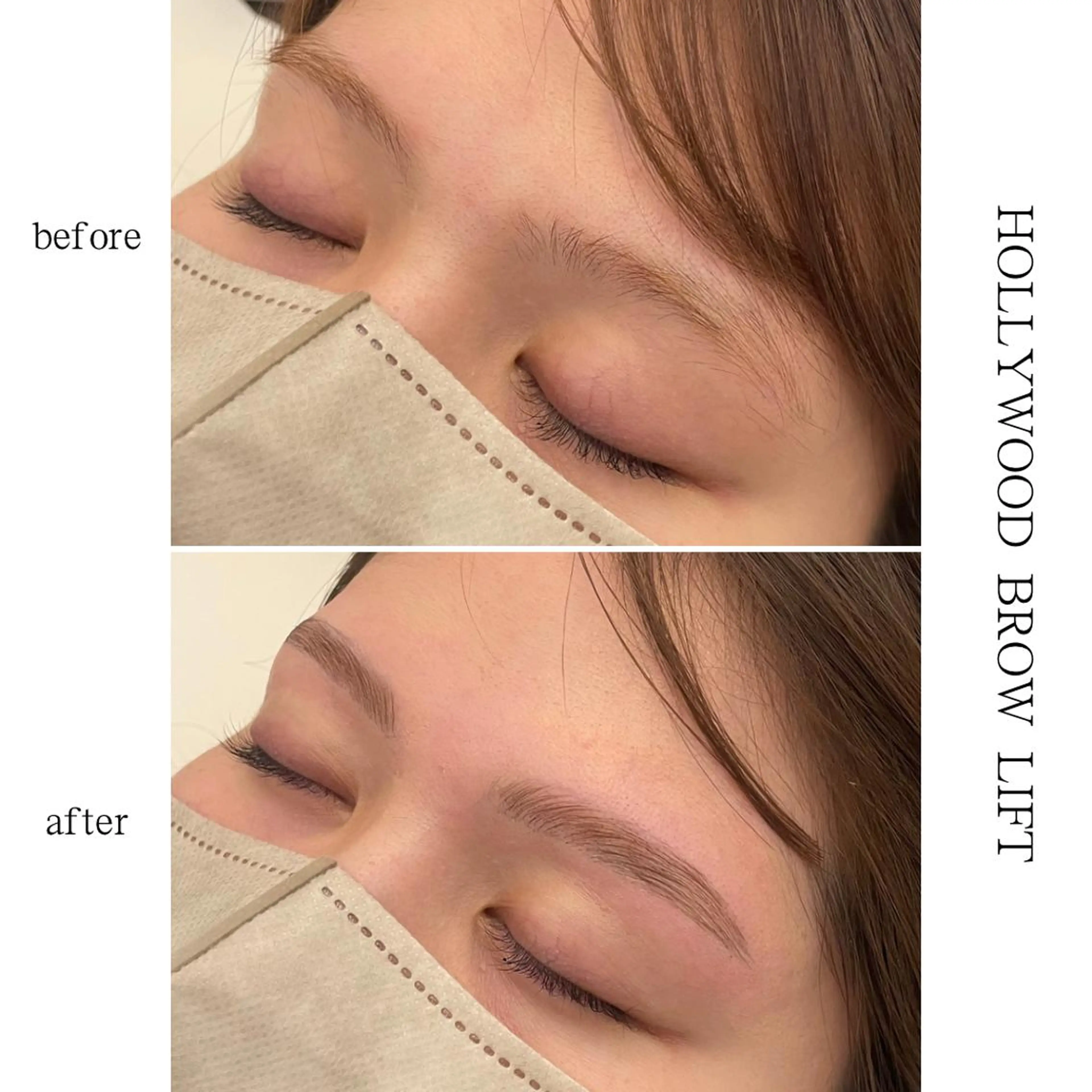 HOLLYWOOD BROW LIFTの写真