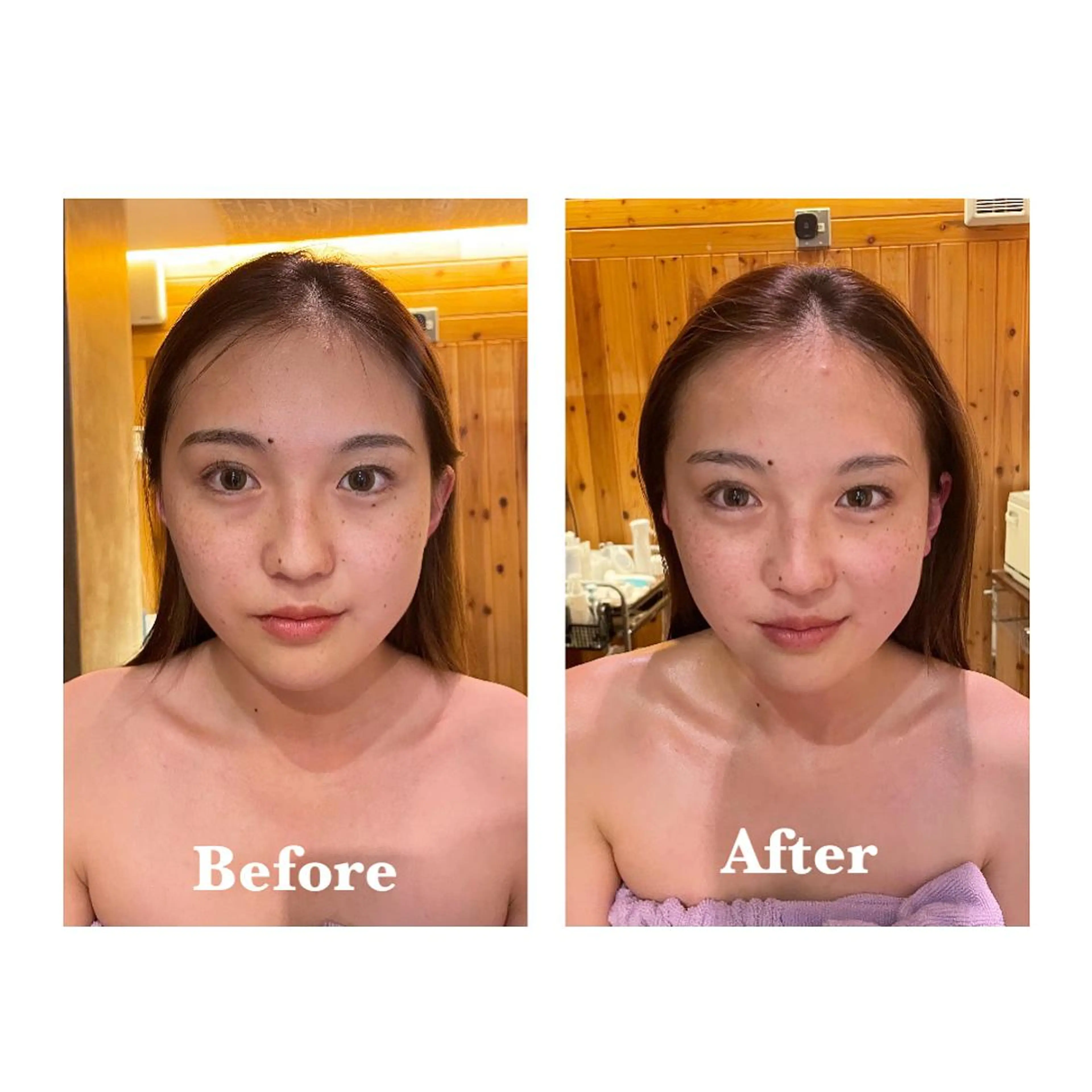 【学生限定】プチフェイシャル🧚🏻‍♀️ 60min 【1回で分かる、本気の肌改善】の写真
